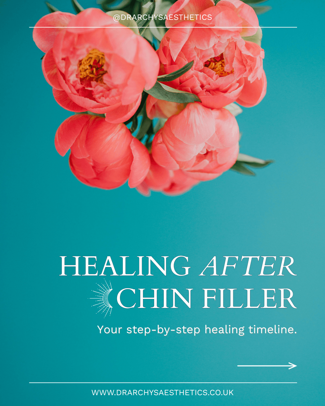 Dr Archy's Aesthetics educational post: 'Healing after chin filler — your step-by-step healing timeline' — social media content by Wild Mind Studios
