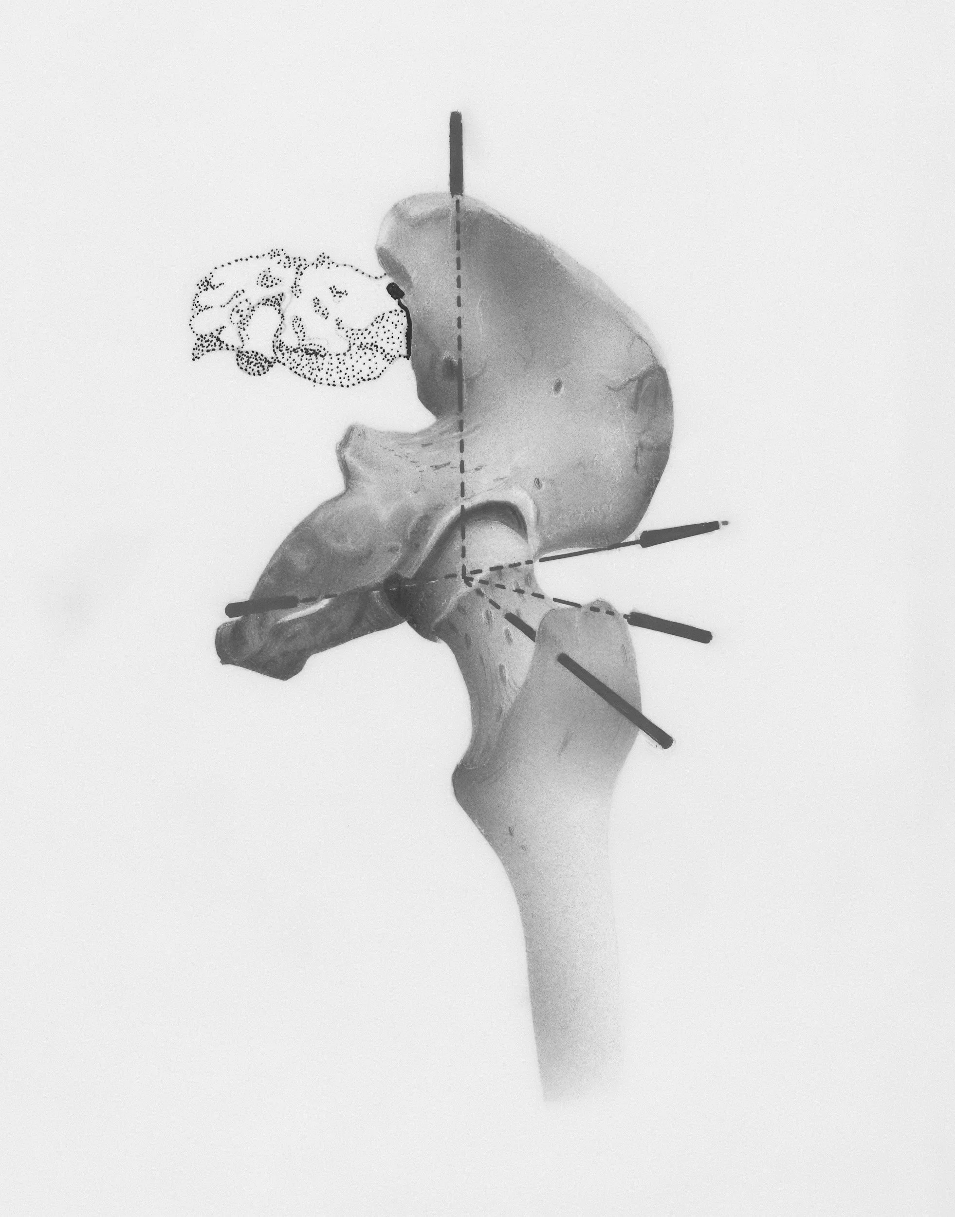 A black and white image of a human hand holding a knife. The knife is piercing a model of a human head, which appears to be sliced in half, showing the interior. There are dotted lines and arrows indicating a diagrammatic or medical illustration.