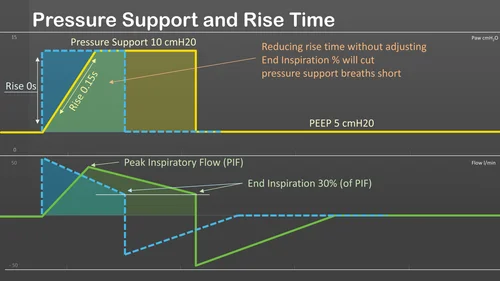 Pressure Support and Rise Time — Airway Academy