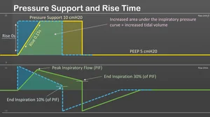 Pressure Support and Rise Time — Airway Academy