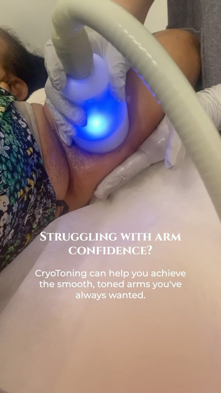 Get ready to show of your arms this summer! ๐ช๐ผโ๏ธ
โ
Cryoskin is a perfect treatment for those who want their arms to look nice and toned.
โ
We will create a perfect treatment plan for you to reduce fat pockets and simultaneously tone and tighten you