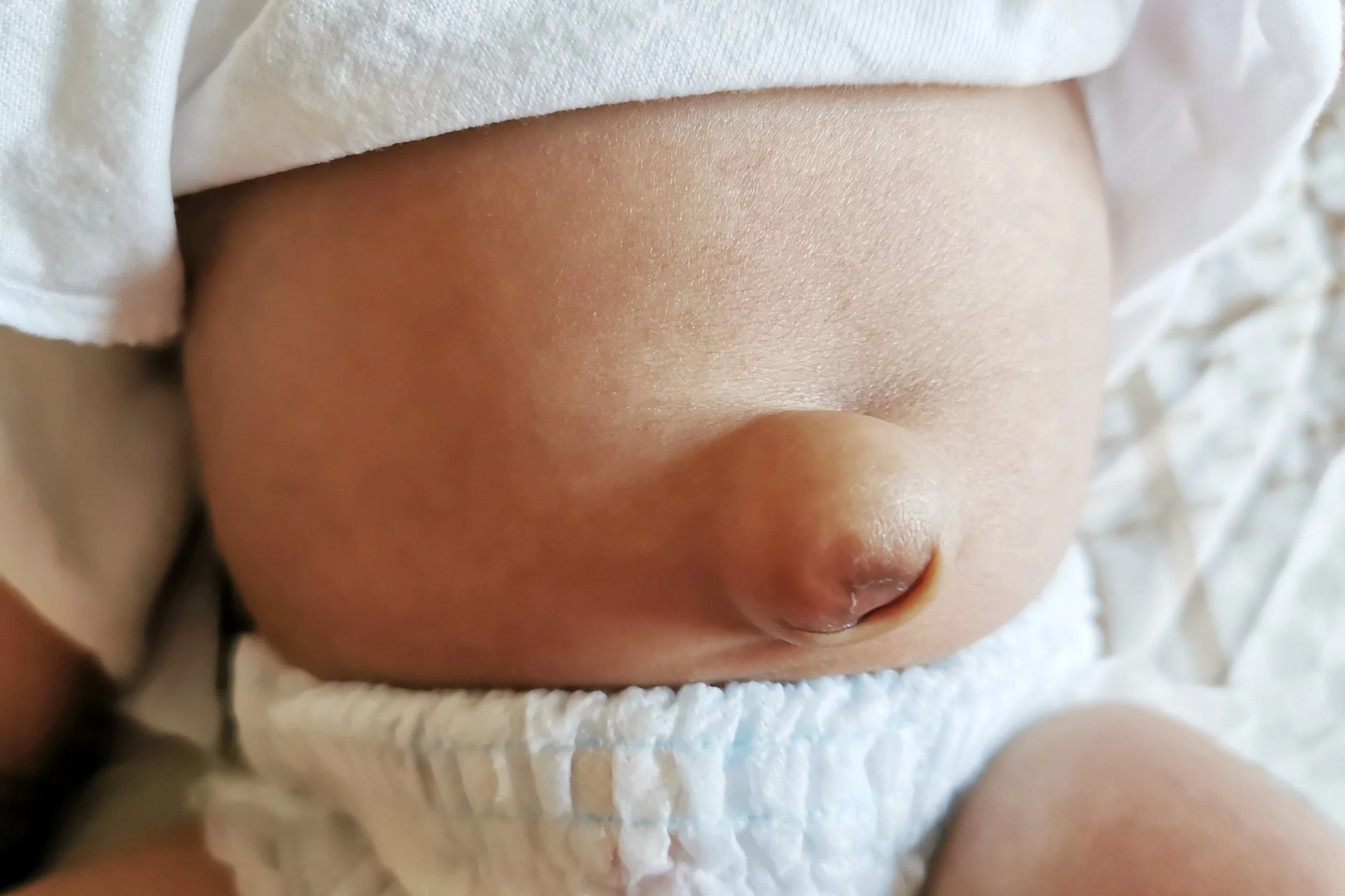 Umbilical Cord Care