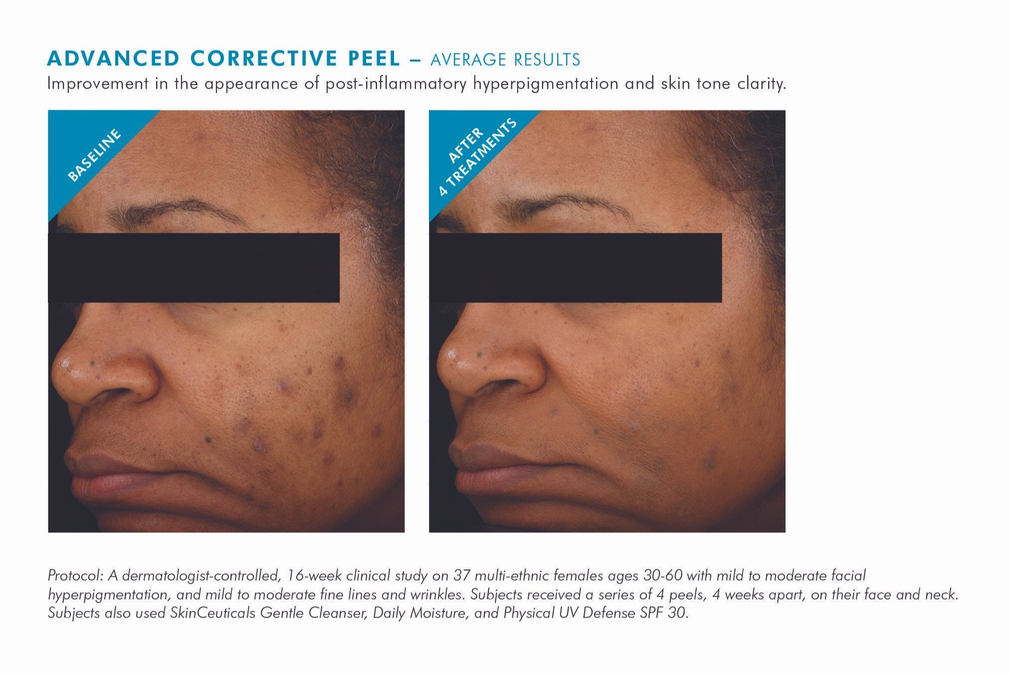 adv+corr+peel+4.jpg