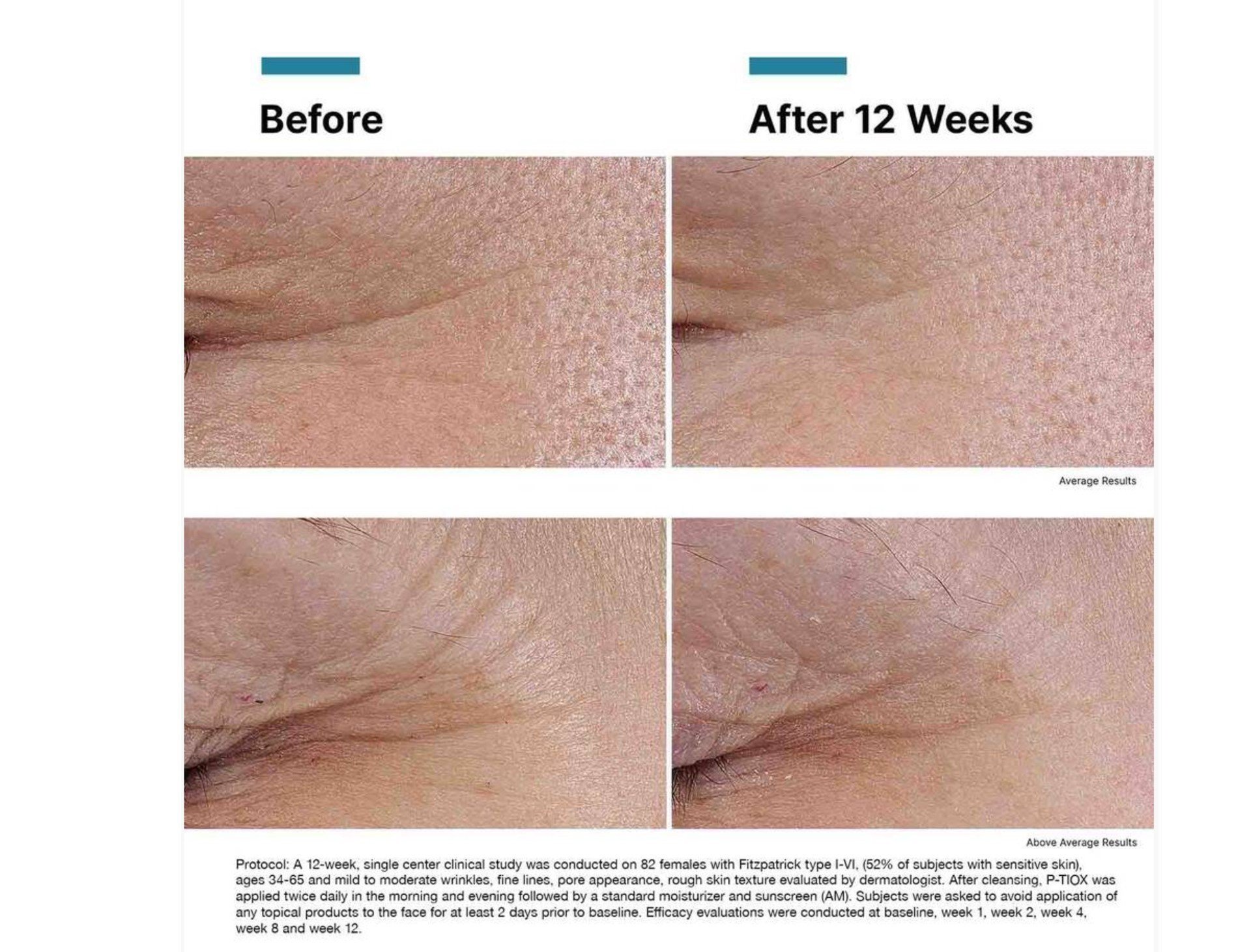 P-TIOX+BEFORE+AFTER.jpg
