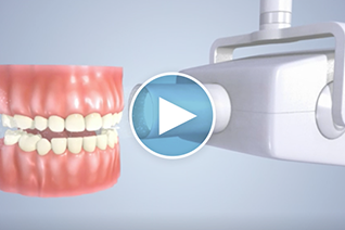 3. Digital Intra Oral X-rays.png