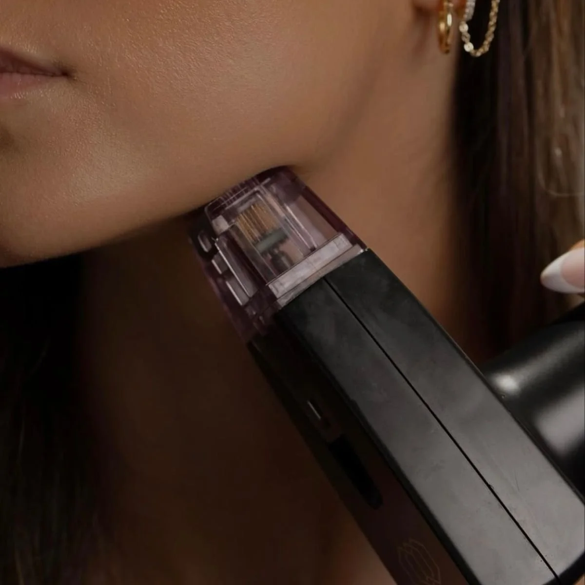 Morpheus8 treatment in Hallandale Beach for skin tightening