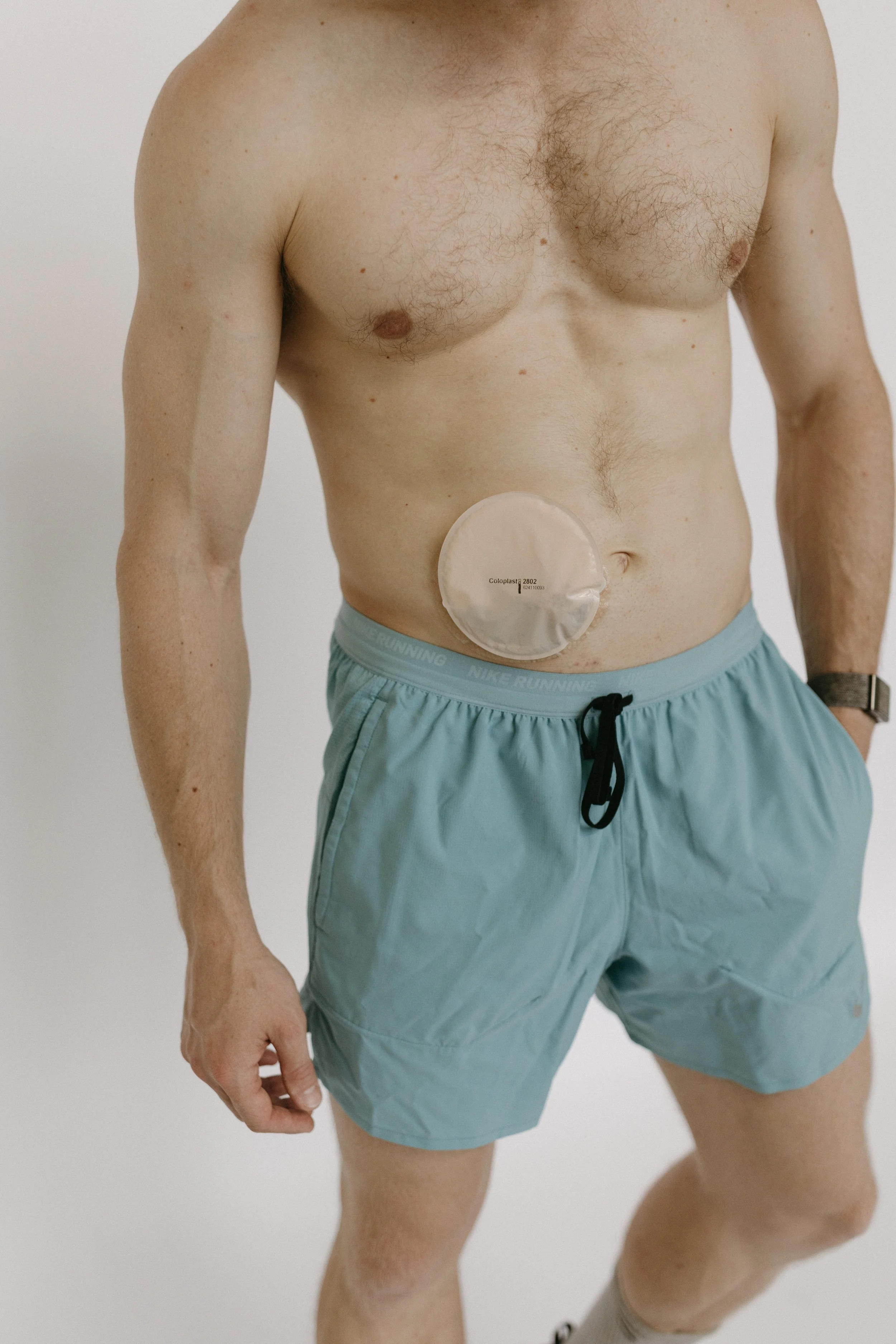 A shirtless man wearing light blue Nike running shorts, with an ileolostomy bag attached to his abdomen, standing against a plain white background.