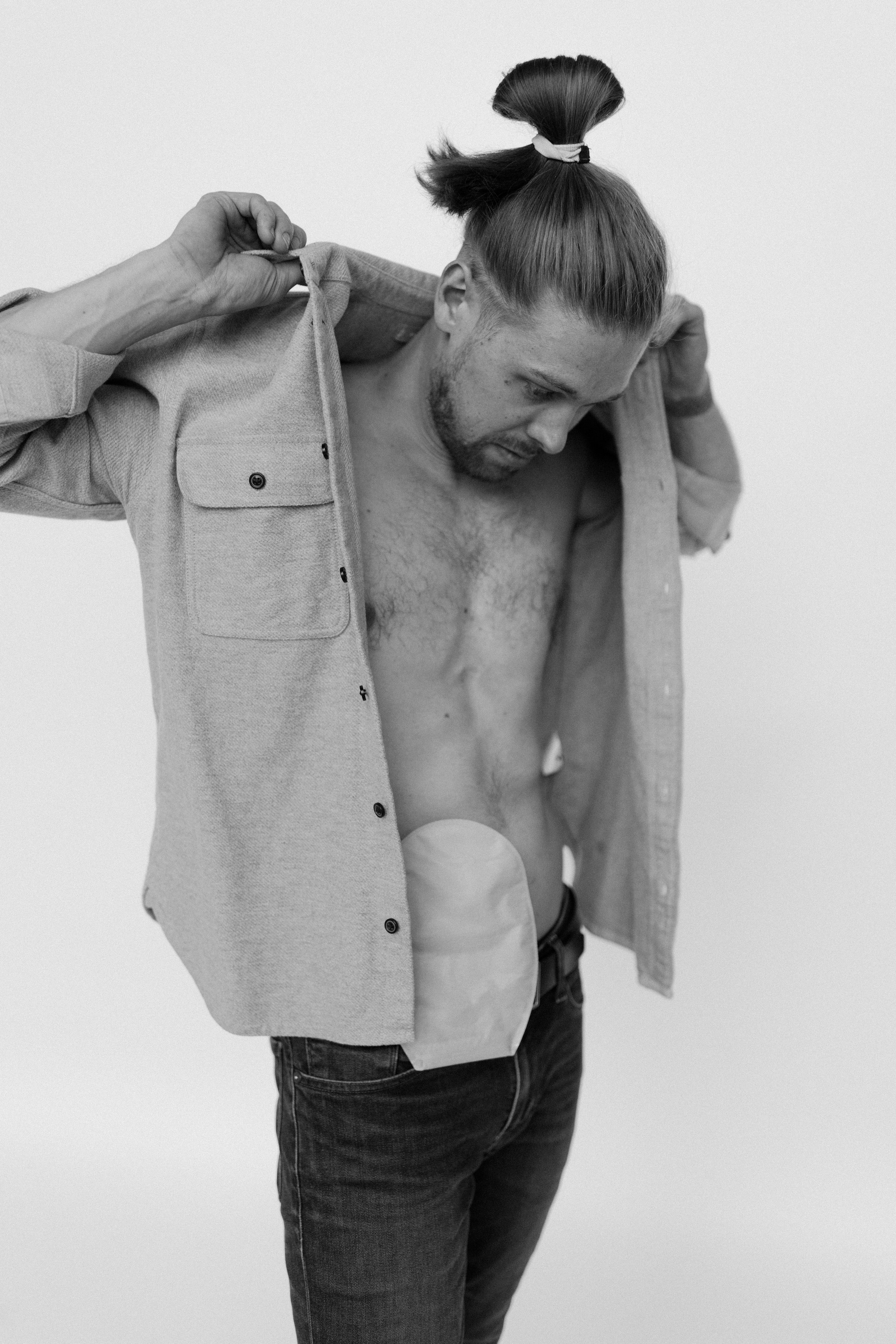 A shirtless man with a man bun is removing his jacket, revealing his ileostomy bag on his right side.