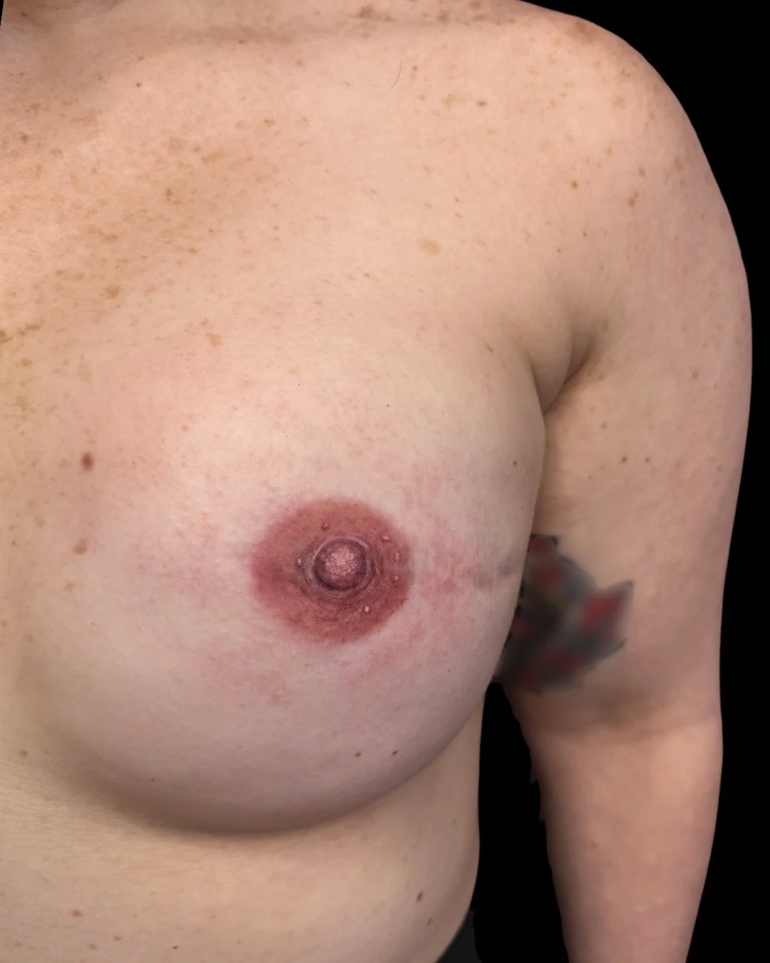 3D areola and nipple tattoo