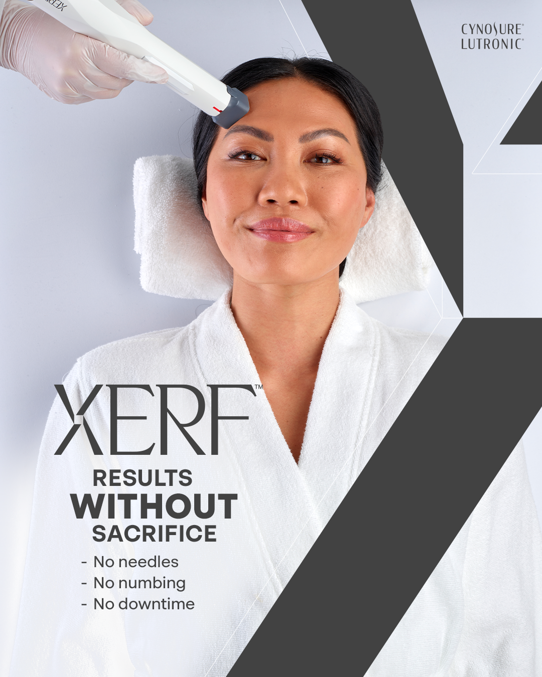 A woman receiving a non-invasive cosmetic treatment on her forehead with a handheld device in a clinical setting. The image promotes XERF results without sacrifice, highlighting no needles, no numbing, and no downtime.