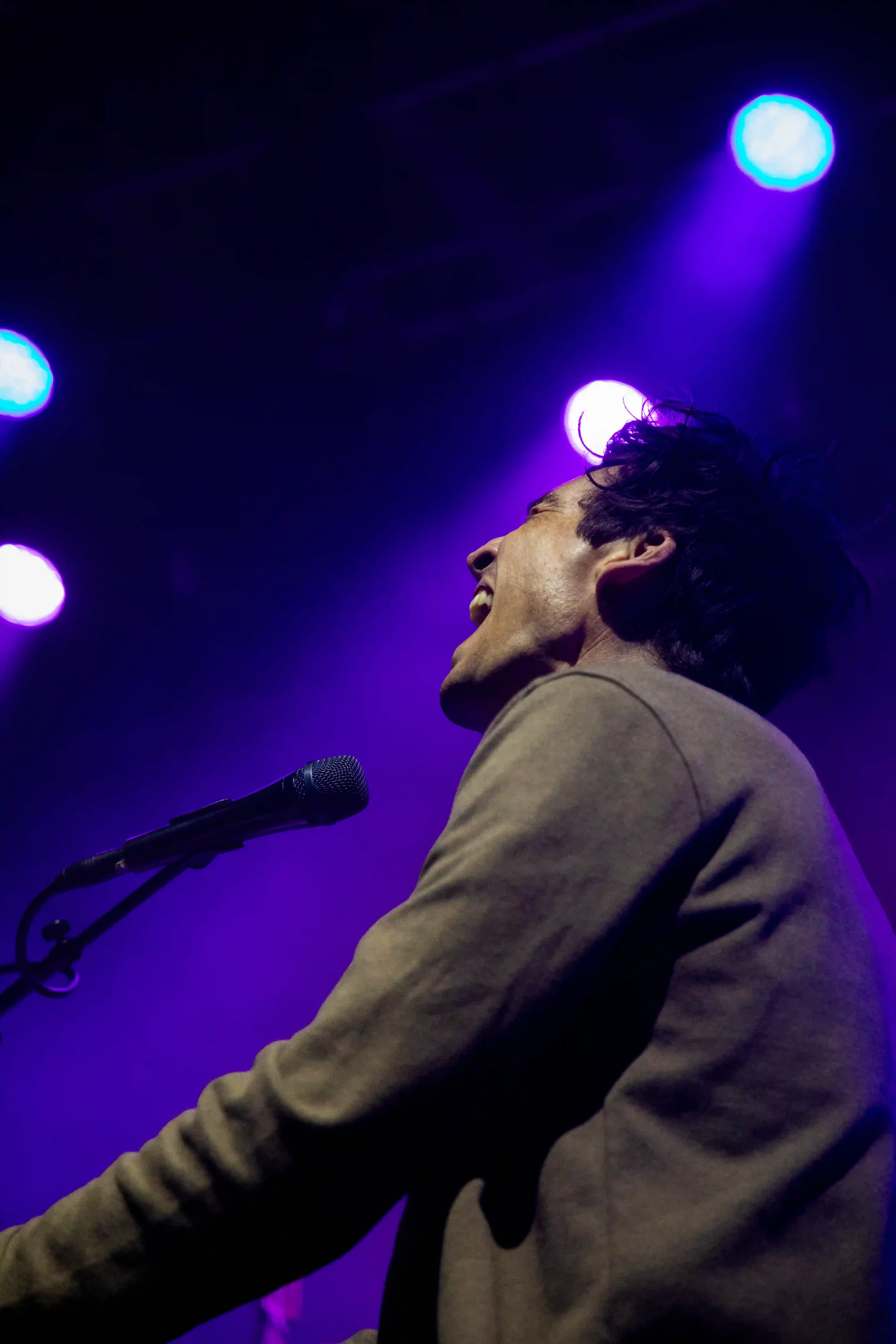 Augustana- Mouth Wide NO WATERMARK.webp