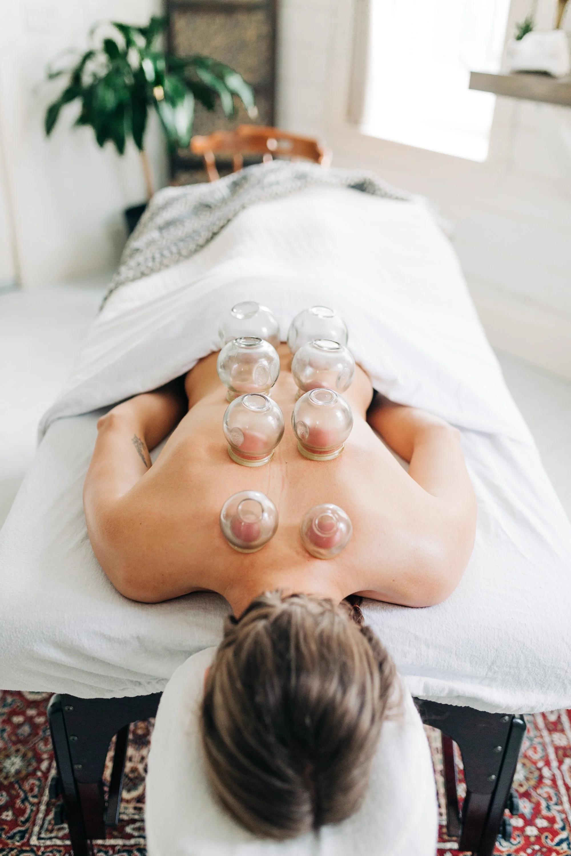Fire Cupping on Back