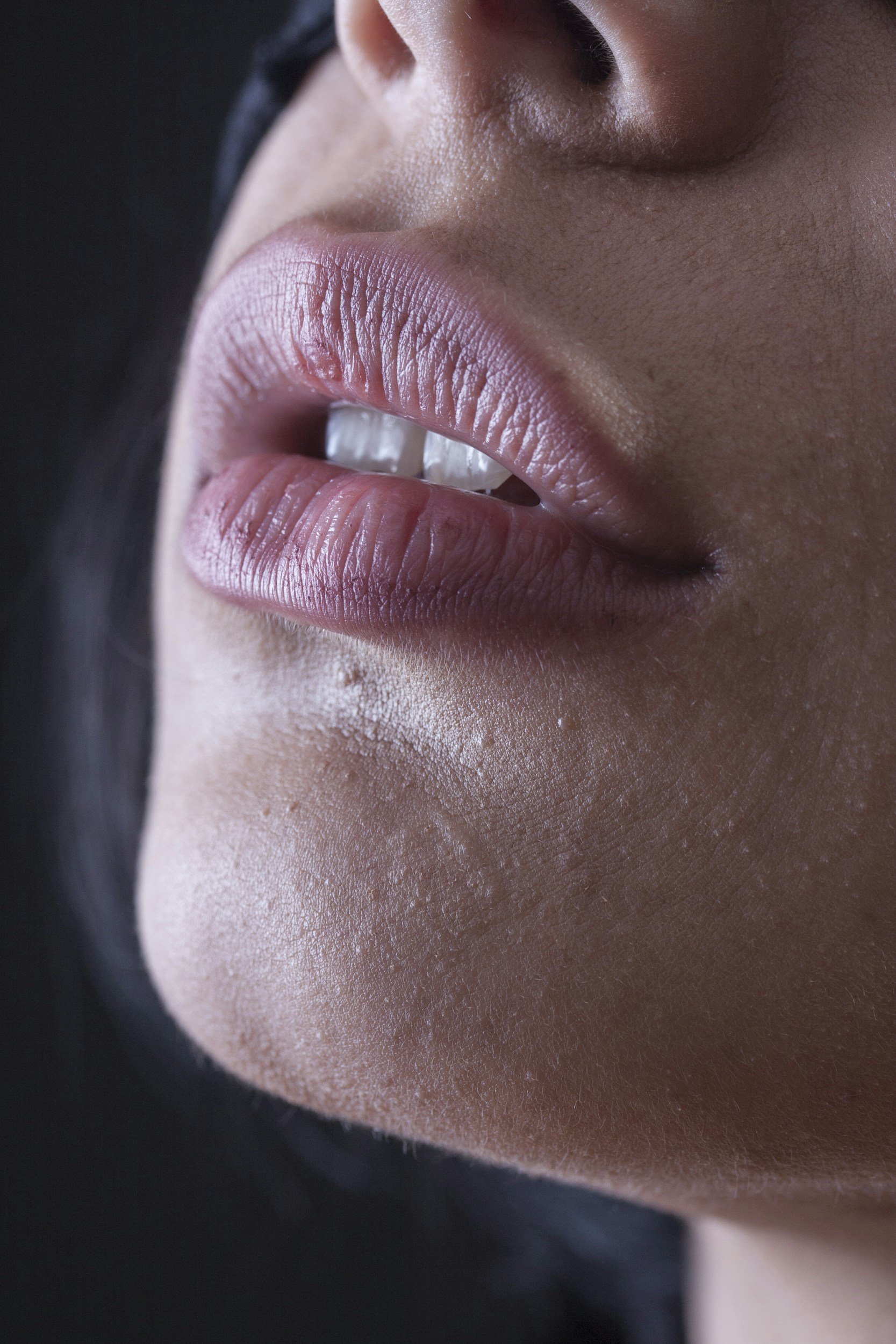 Close-up of a woman's mouth lines