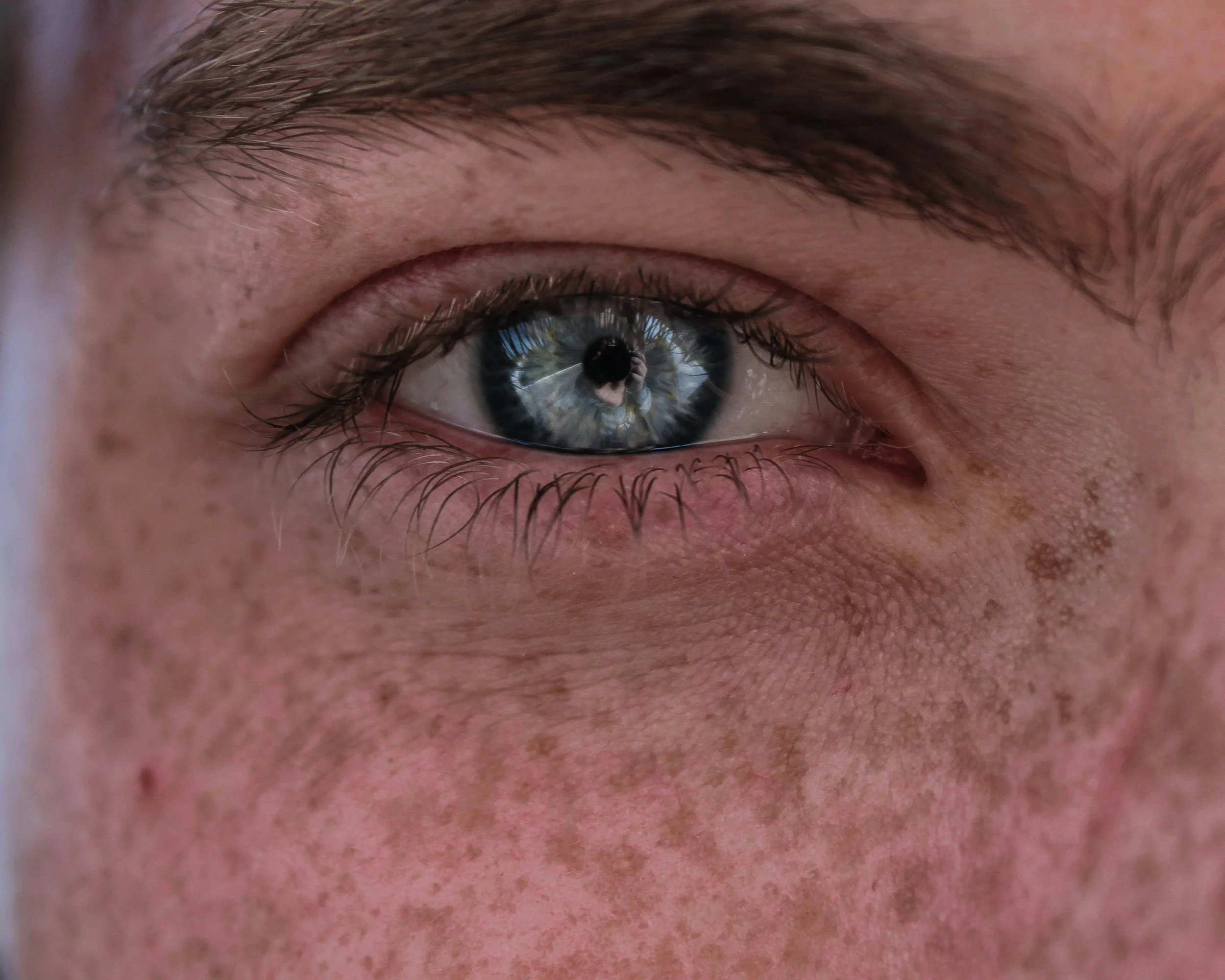 closeup of woman's face with crows feet wrinkles