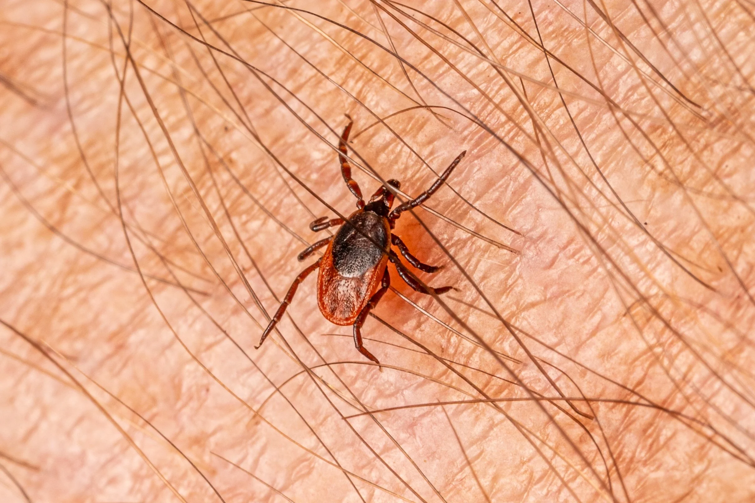 Eastern Black-legged Tick
(Ixodes scapularis, Ixodidae)
Emmerling Community Park, Pennsylvania