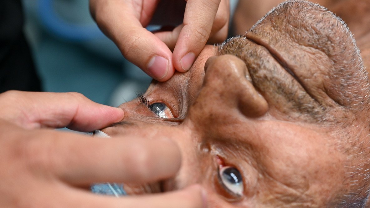 Close-up of a person receiving an eye examination.