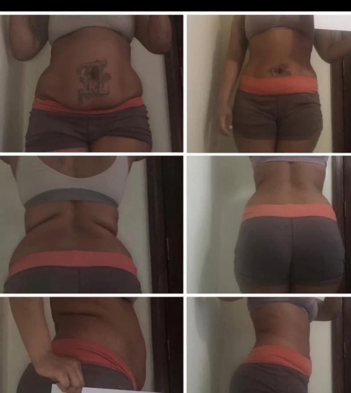 Series of six photos showing a woman's torso from different angles before and after weight loss, showing reduced body fat and slimmer waist and hips.