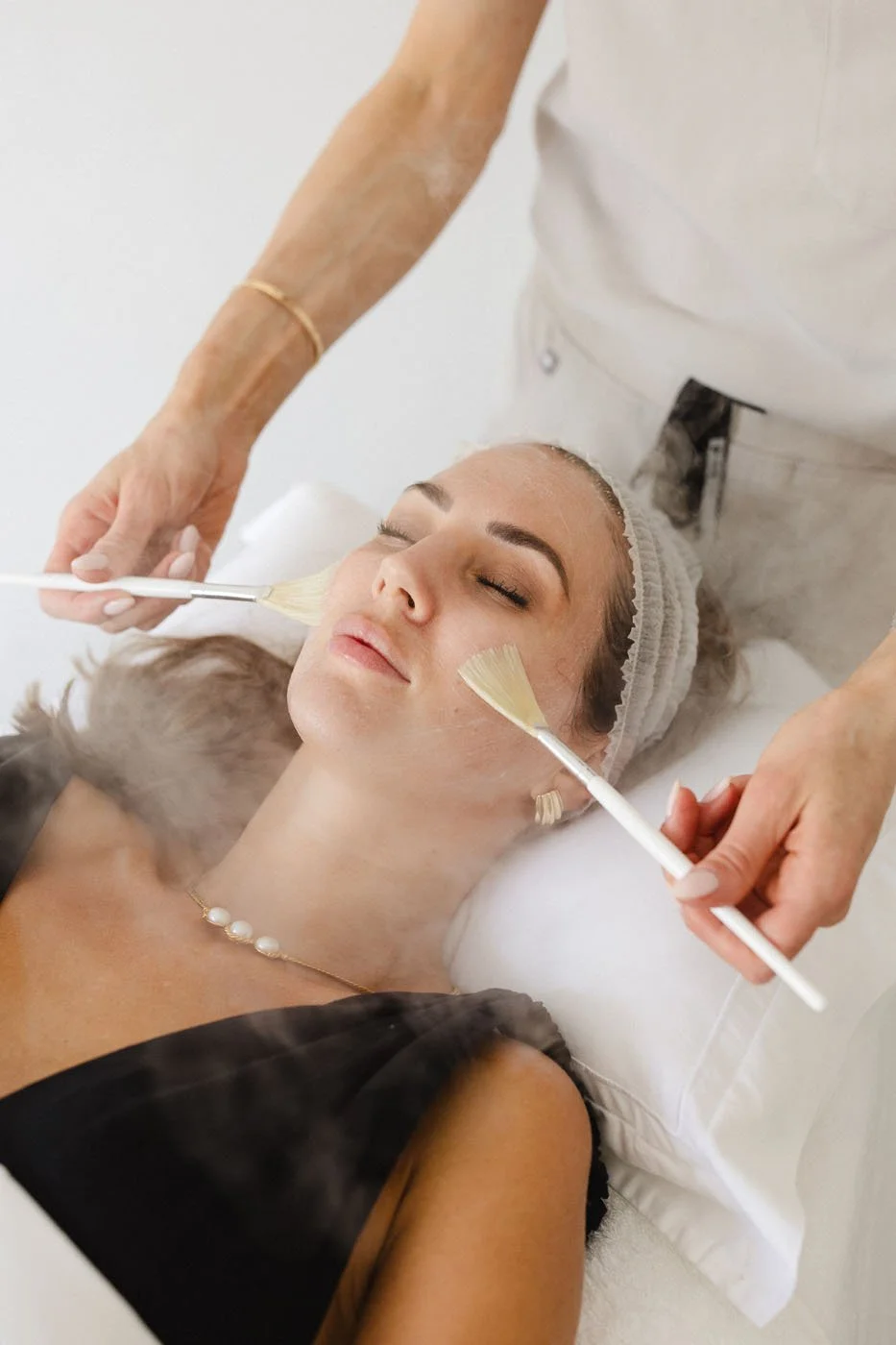 Chemical peels derby