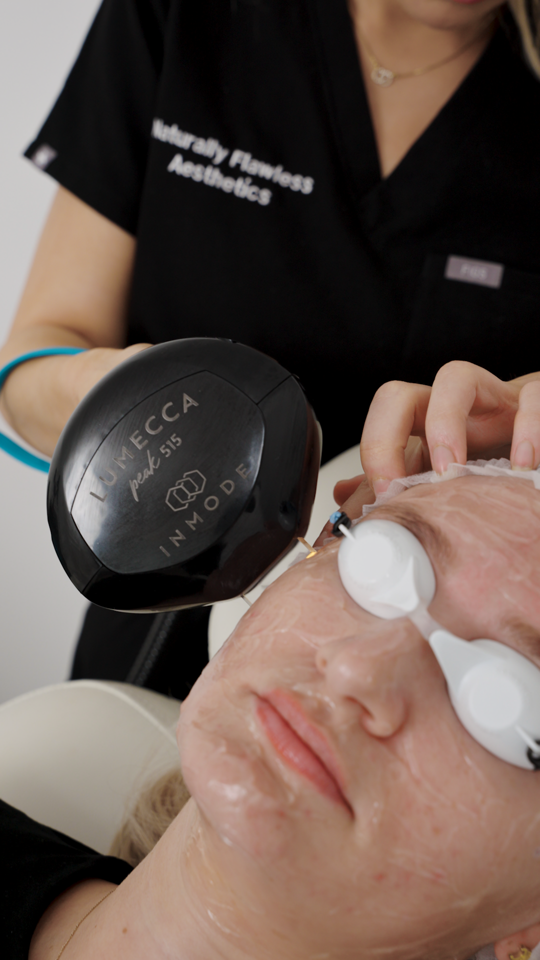 Pigmentation and rosacea treatment in derby carried out by a female skin specialist.