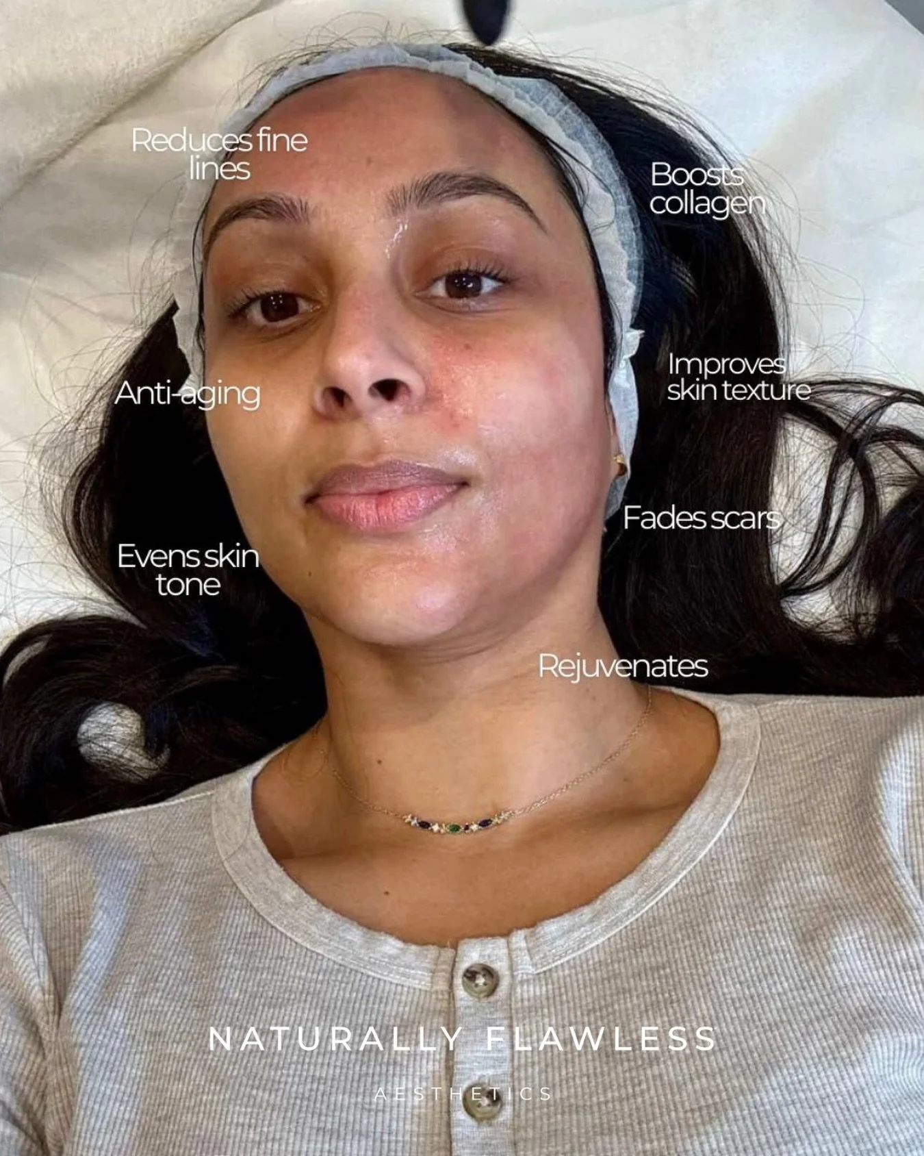 Designed for precision and effectiveness, SkinPen supports healthy, rejuvenated skin with results you can see and feel 💙

#healthyskin #skinbarrier #skinpen #expertfacial #microneedling