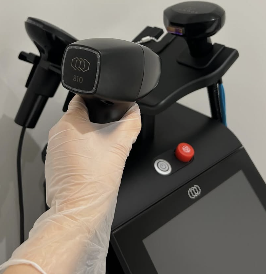 laser hair removal in derby