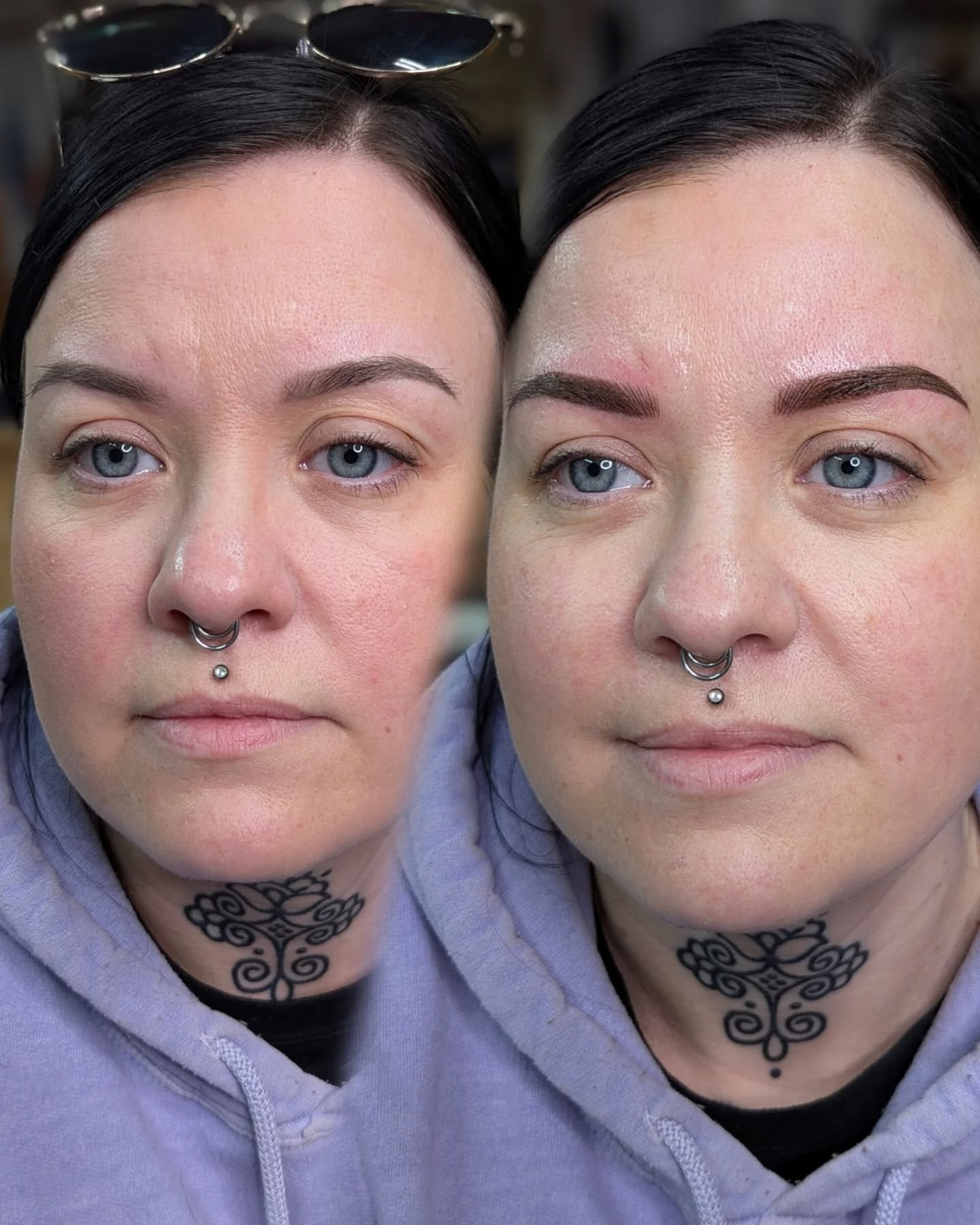 Left; 13.5 month old, nicely healed and faded, combo brows

Right; straight after 13.5 month refresh

Thanks Laura 🥰🥰

--&times;---&times;---&times;---&times;---&times;---&times;---&times;---&times;---&times;---&times;--

💌 𝚂𝙿𝙼𝚄𝚋𝚢𝚂𝚊𝚛𝚊𝚑@
