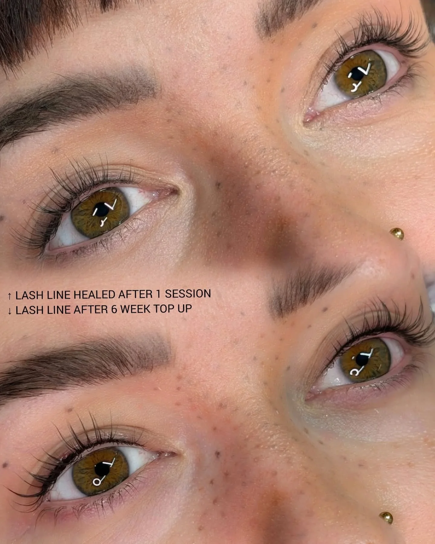 Lash line healed &amp; after 6 week top up 🖤🩷

--&times;---&times;---&times;---&times;---&times;---&times;---&times;---&times;---&times;---&times;--

💌 𝚂𝙿𝙼𝚄𝚋𝚢𝚂𝚊𝚛𝚊𝚑@𝚐𝚖𝚊𝚒𝚕.𝚌𝚘𝚖
🔗 𝚠𝚠𝚠.𝚂𝙿𝙼𝚄𝚋𝚢𝚂𝚊𝚛𝚊𝚑.𝚌𝚘𝚖

--&times;---&