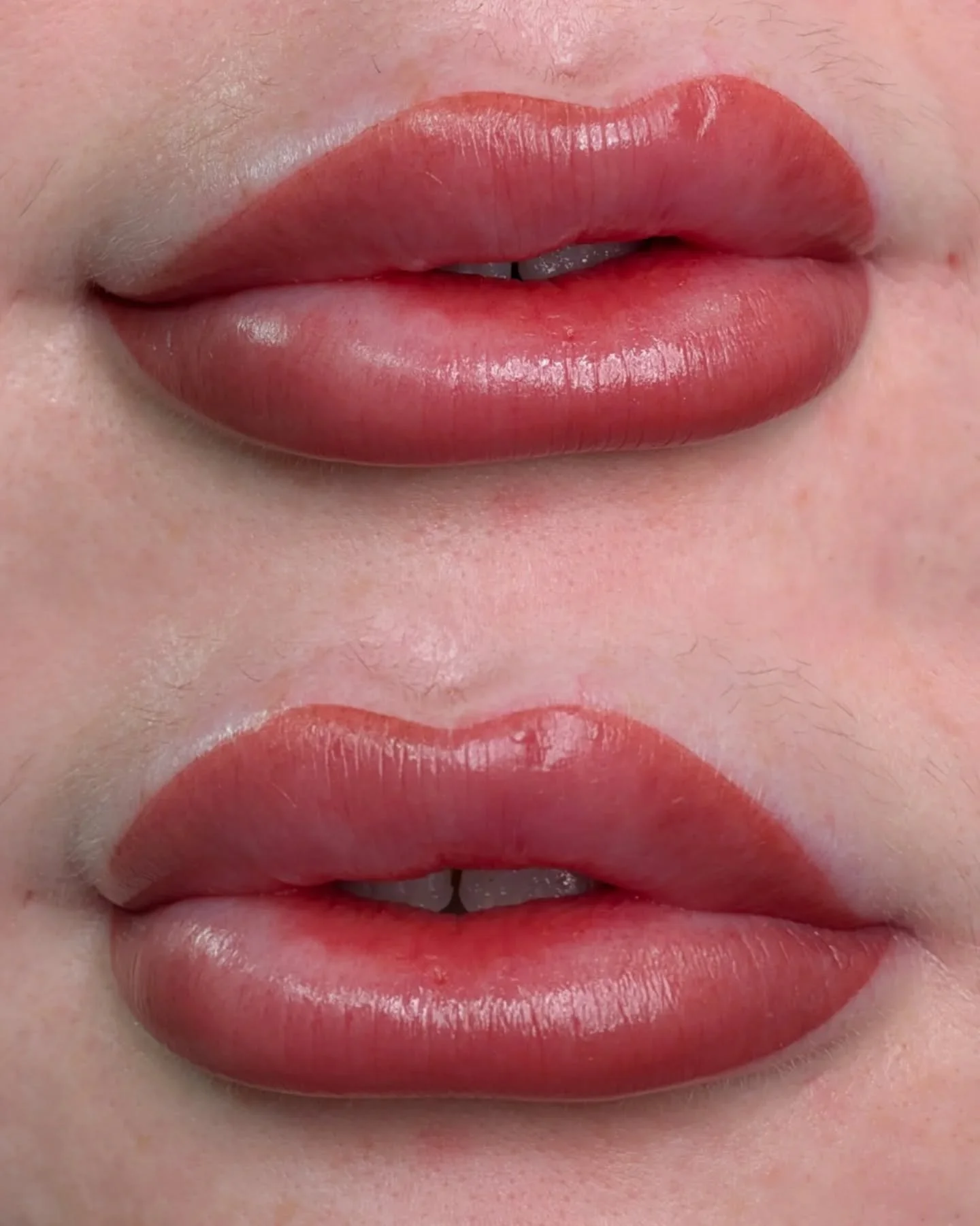 19 month lip refresh for Coral. Swelling obviously present, which will subside!

★ Second pic shows before refresh &amp; after refresh ★

★ Third pic shows Coral's lips in December 2023 before she had lip blush done, and then September 2025; before t