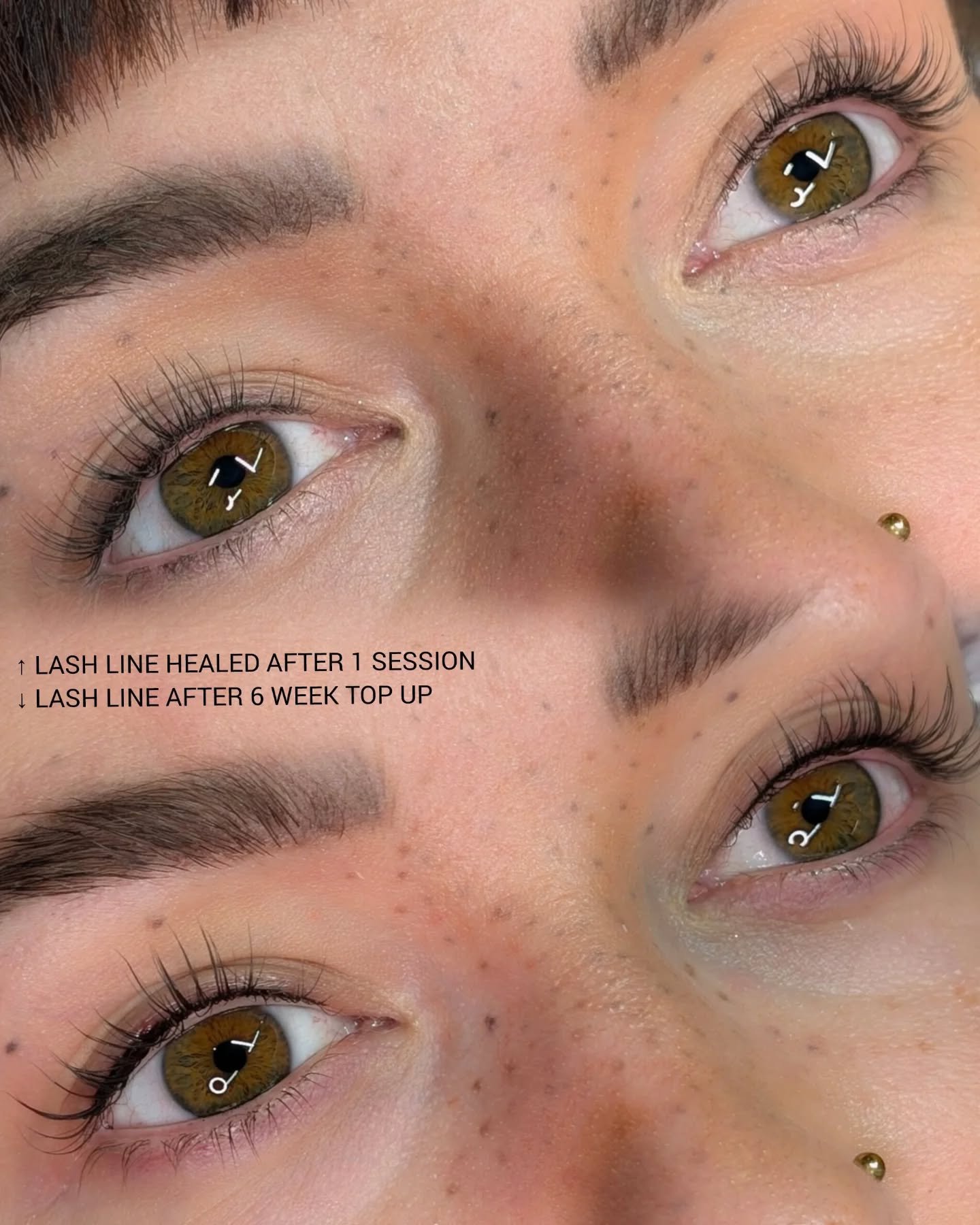 Lash line healed &amp; after 6 week top up 🖤🩷

--&times;---&times;---&times;---&times;---&times;---&times;---&times;---&times;---&times;---&times;--

💌 𝚂𝙿𝙼𝚄𝚋𝚢𝚂𝚊𝚛𝚊𝚑@𝚐𝚖𝚊𝚒𝚕.𝚌𝚘𝚖
🔗 𝚠𝚠𝚠.𝚂𝙿𝙼𝚄𝚋𝚢𝚂𝚊𝚛𝚊𝚑.𝚌𝚘𝚖

--&times;---&
