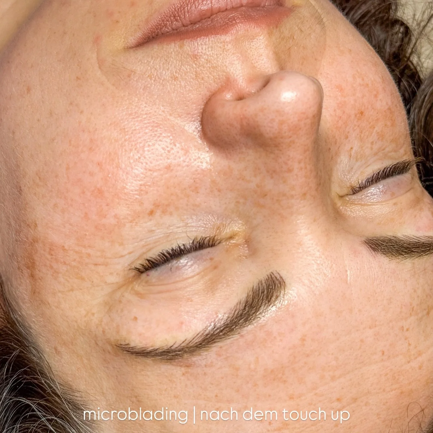 Microblading &amp; Touch up 8 Wochen sp&auml;ter

Erst das Touch up macht die ganze Augenbraue rund. Ich bin in love.

#cosmentictattooing #microblading #hyperrealisticmicroblading #browsbrowsbrows #browsonfleek #naturalmicroblading