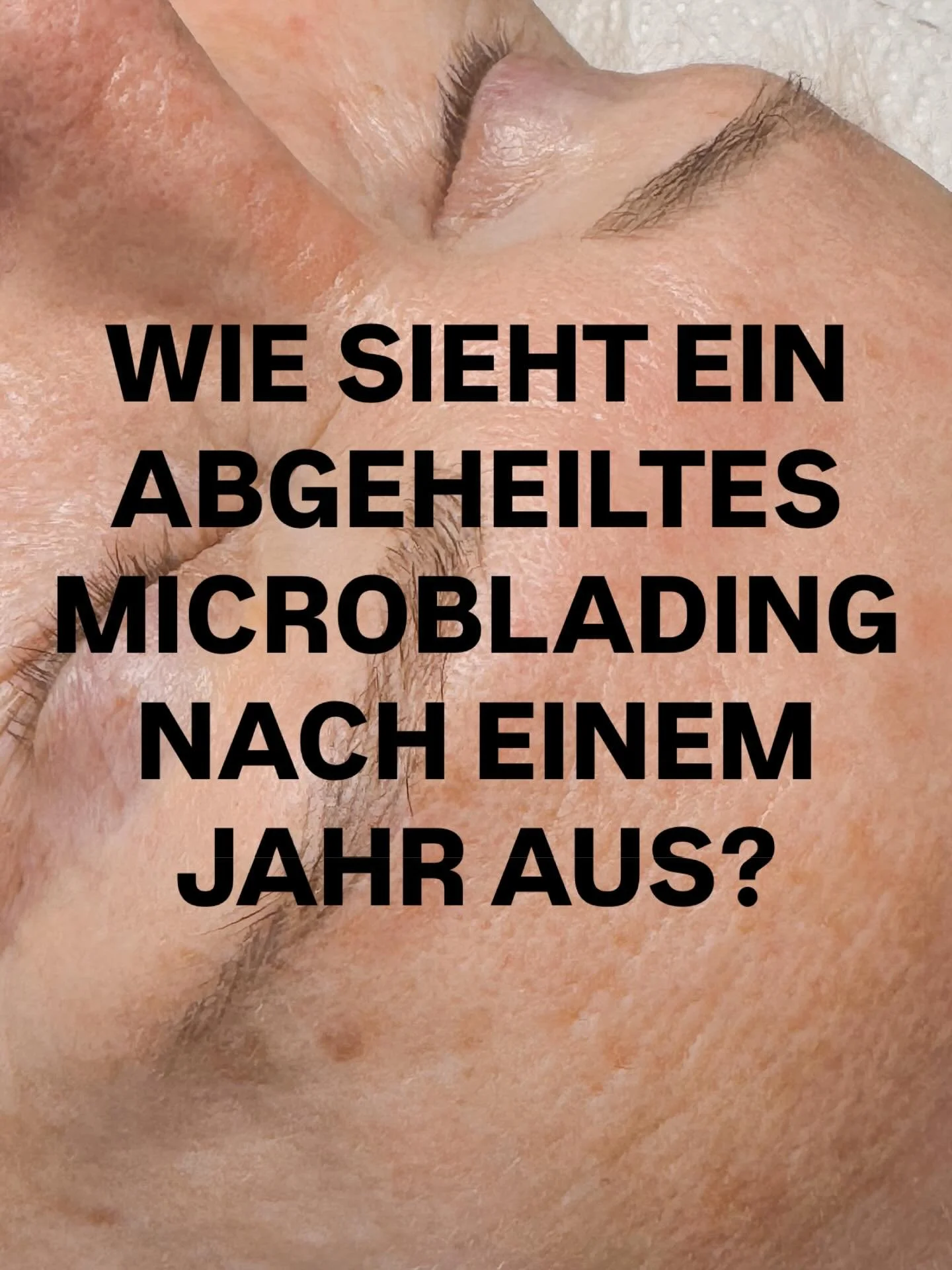 Viele fragen sich wie ein Microblading nach ein, zwei oder drei Jahren aussehen kann. Hier haben wir ein Microblading, das insgesamt ein bisschen breiter pro H&auml;rchen verheilt, weil es sich hierbei um eine Haut handelt, die grobe Poren mit sich b