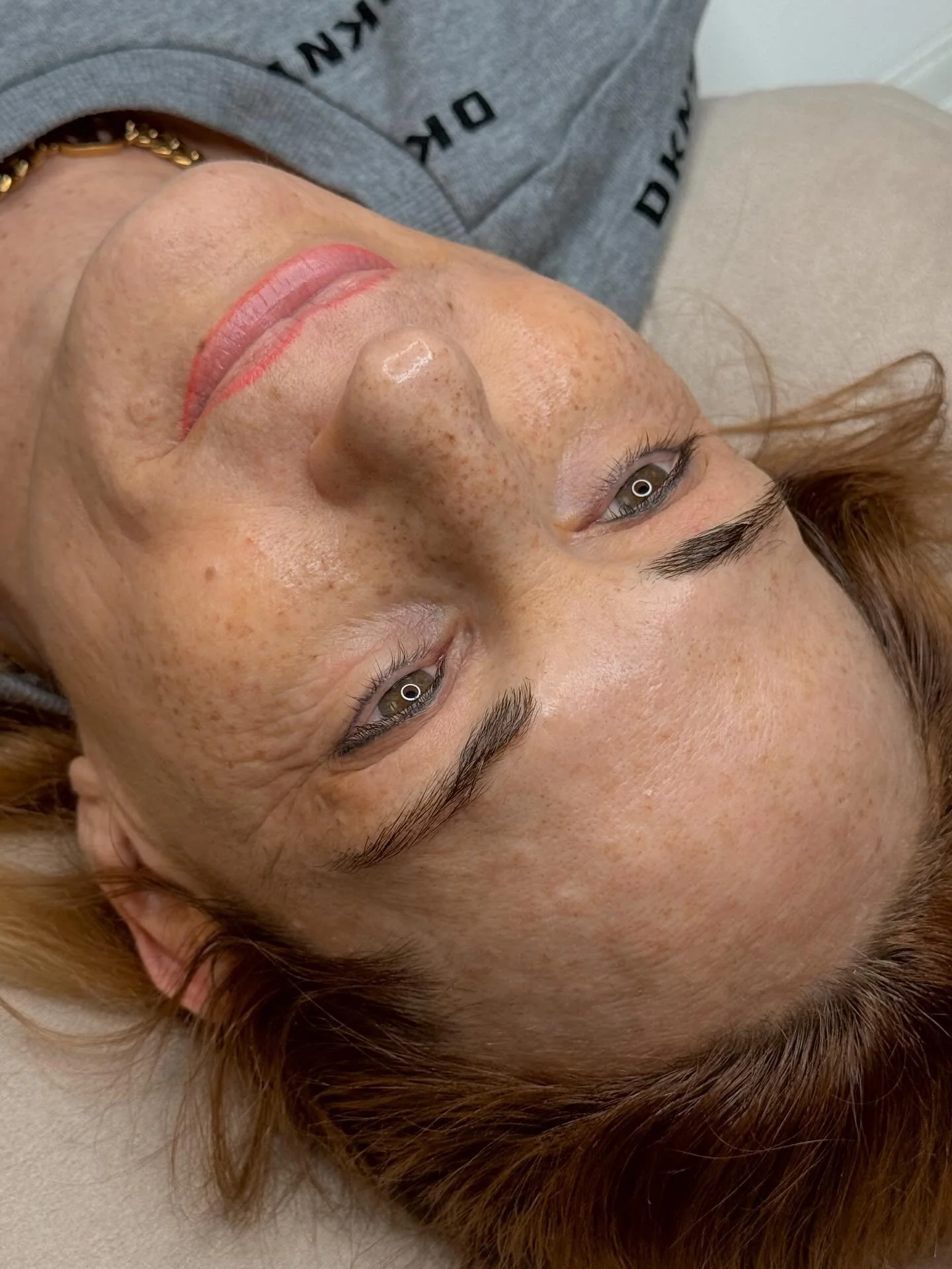 Sommersprossen haben sie schon ihr ganzes Leben begleitet. ❤️ 

Als Kind und junge Erwachsene hatte sie von Natur aus viele Freckles &ndash; und hat sie immer geliebt.
Mit den Jahren sind diese jedoch immer mehr verblasst, weshalb sie sich ihre Somme