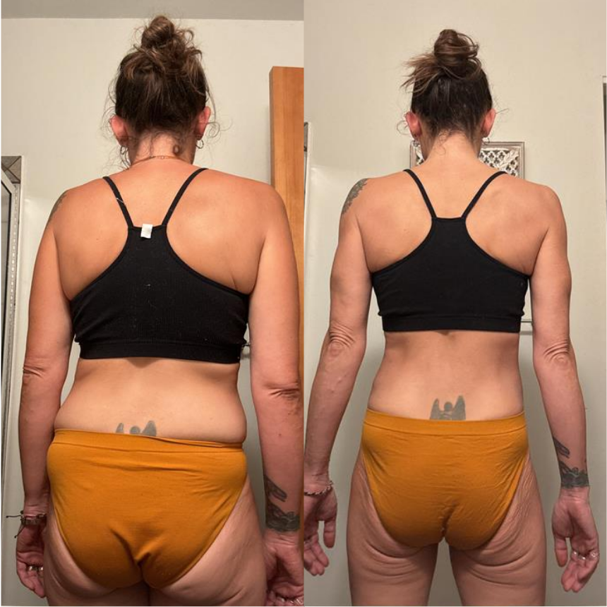 BeforeAfter – 11.png
