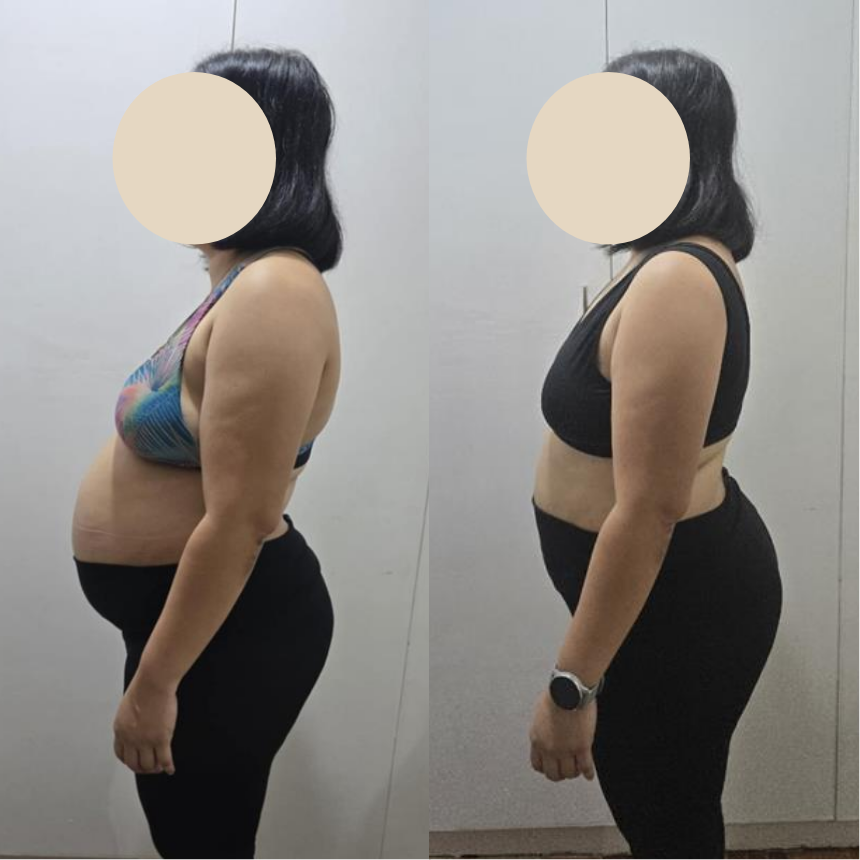 BeforeAfter – 9.png