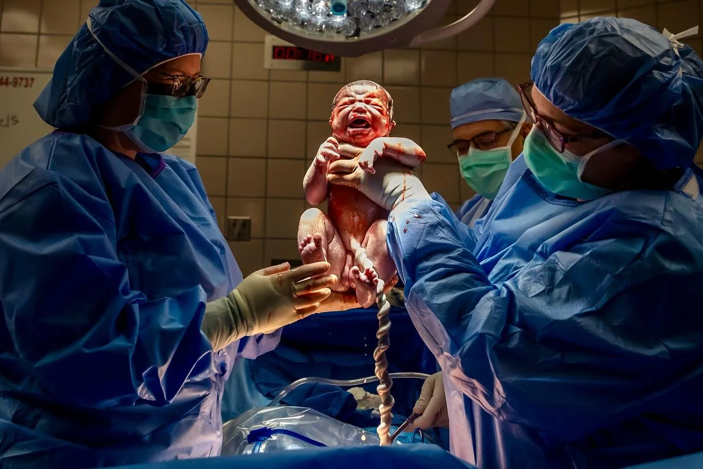 Sharing a few special moments from a recent C-section birth. Being in the OR to capture that moment when you first see your baby being lifted up is a privilege I don&rsquo;t take lightly. And to have the opportunity to capture that first skin to skin