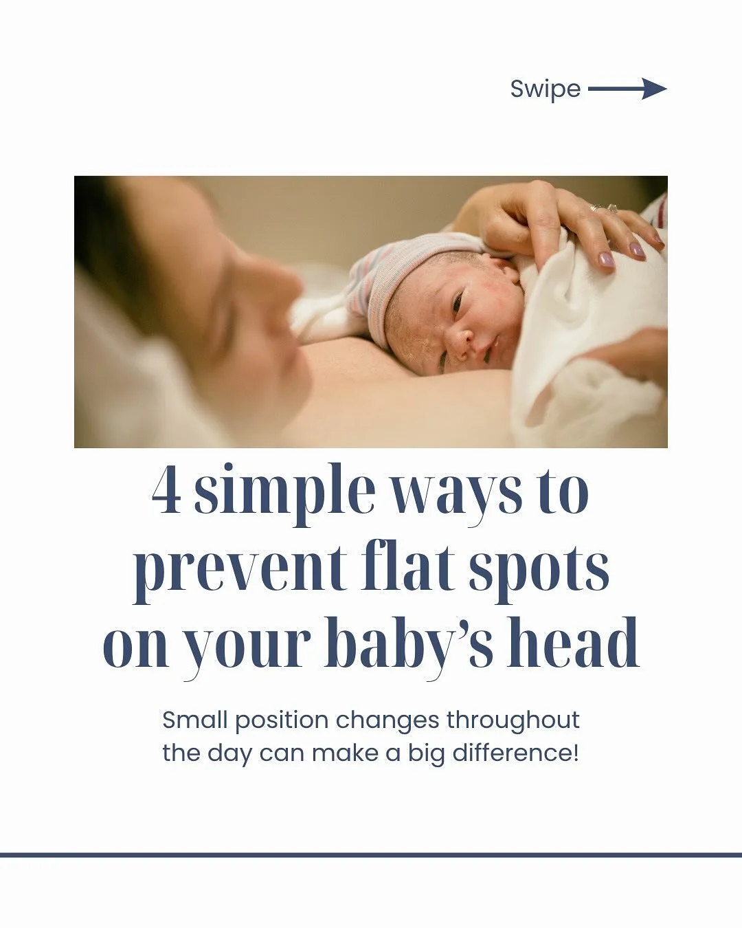 Flat spots are common&mdash;and often preventable with simple daily habits.

Safe sleep still means placing babies on their backs to sleep. But during awake time, variety matters. Tummy time, side-lying, carrying, and floor play all help reduce prolo