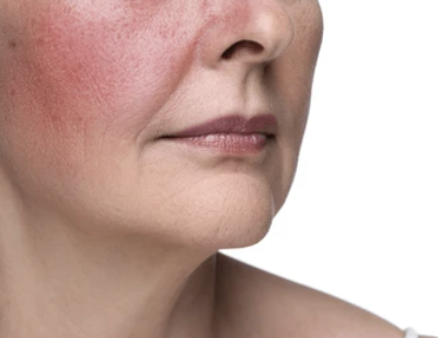Rostro y cuello de una mujer con piel clara y labios cerrados.