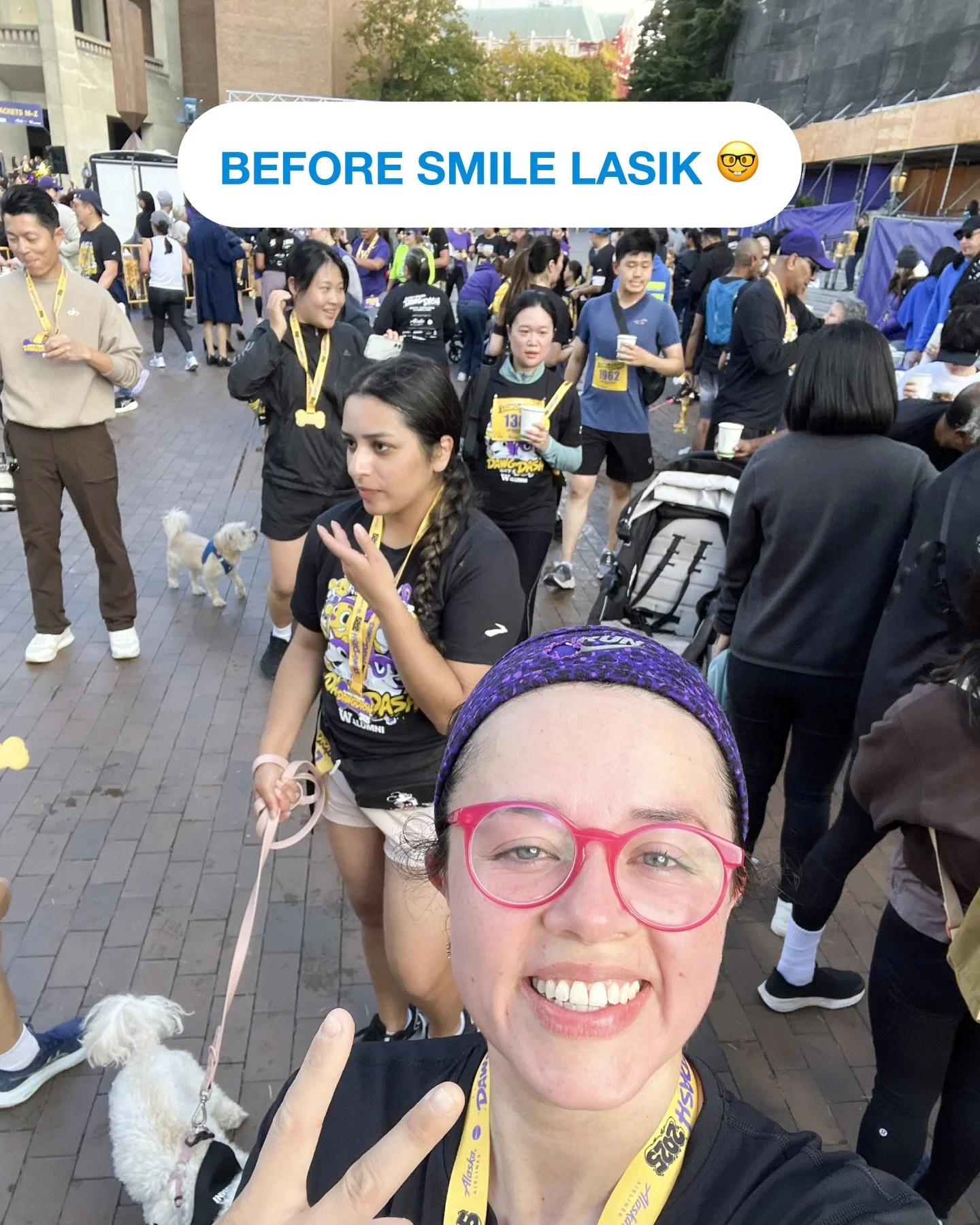 👟👁️ Run Free with Clear Vision ✨🩵

Another incredible before &amp; after from a recent SMILE LASIK patient treated by Dr. Michael Banitt 🧑🏼&zwj;⚕️ in Seattle &mdash; now enjoying the freedom of running without glasses or contacts 🙌.

For active