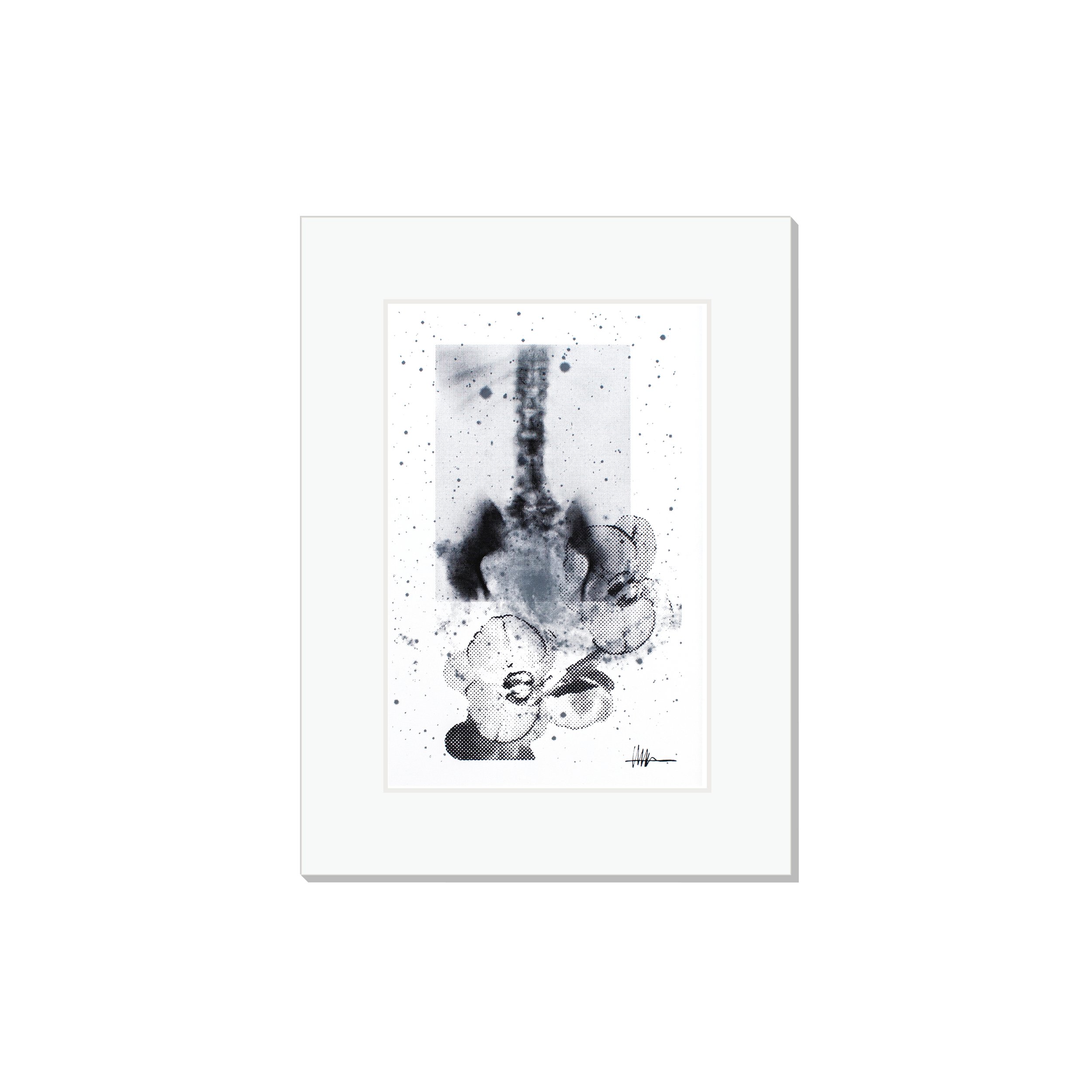 Matted cosmic art print halftoned aortic stenosis X-ray NGC 6946 flowers effloresced gallery affordable calcified nature
