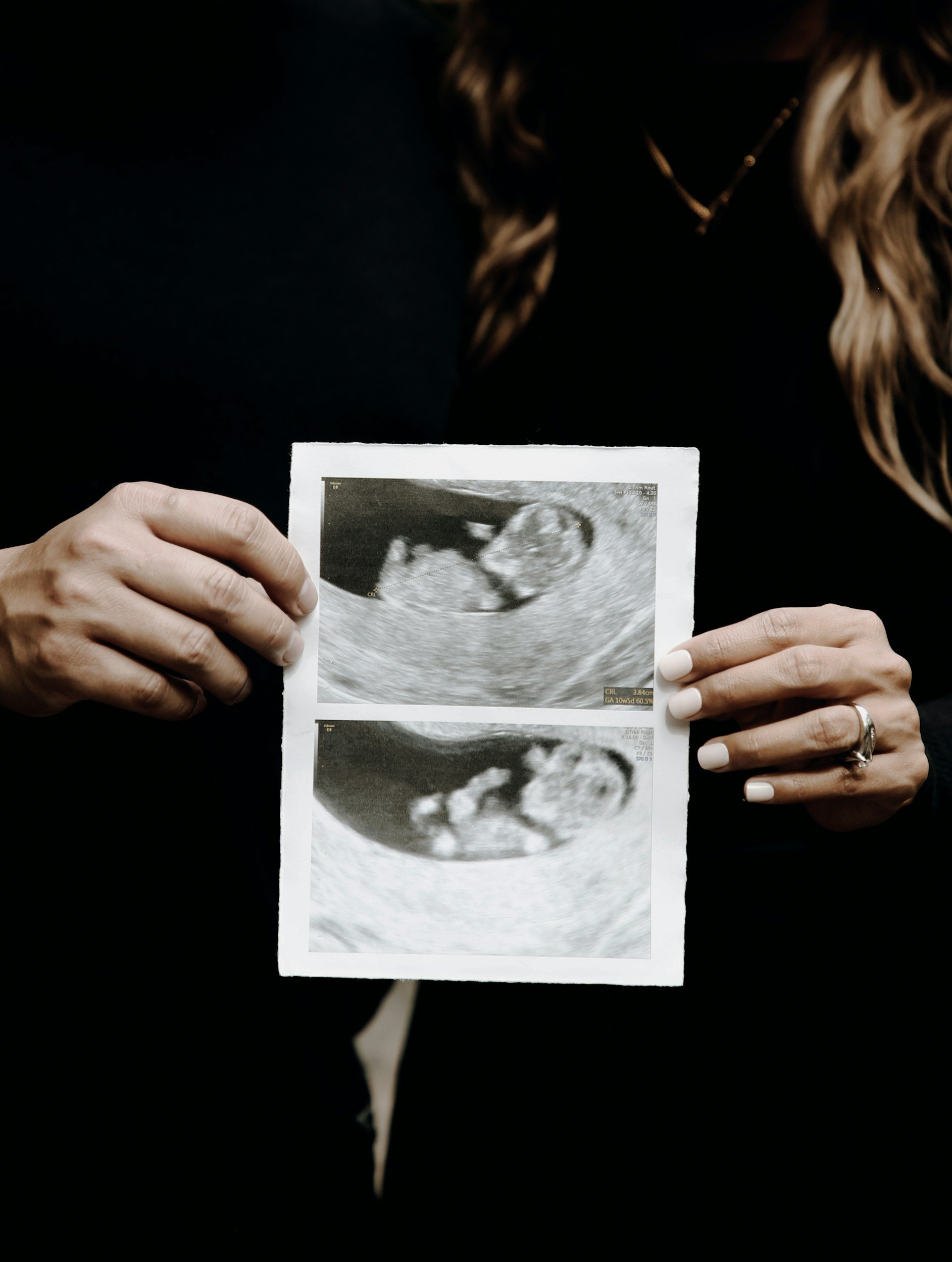 Why we are pro-life