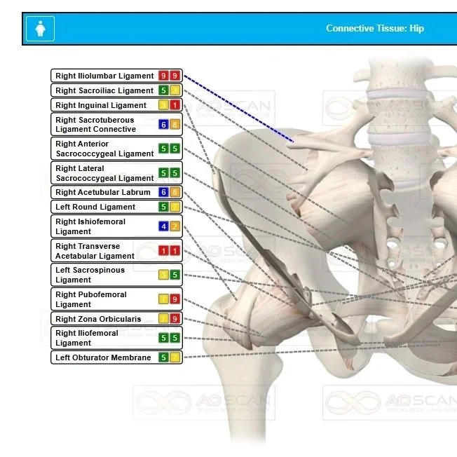 comprehensive AO scan of the hip bones