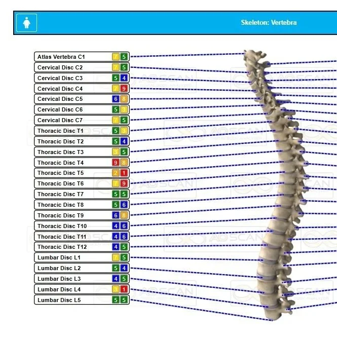 comprehensive AO scan spinal frequencies