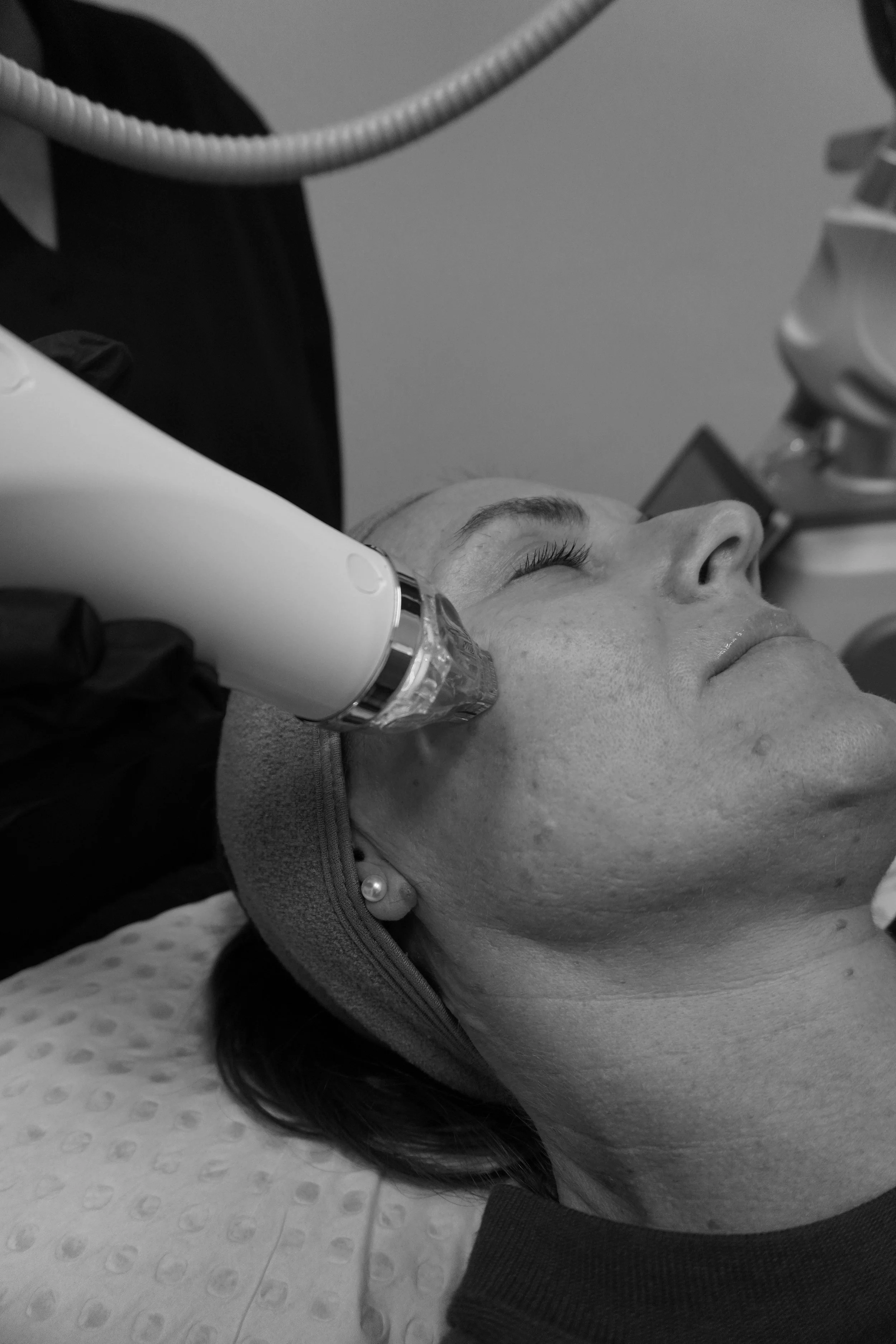 A woman lying down with her eyes closed during a facial treatment, with a medical device applied to her face in a clinical setting.