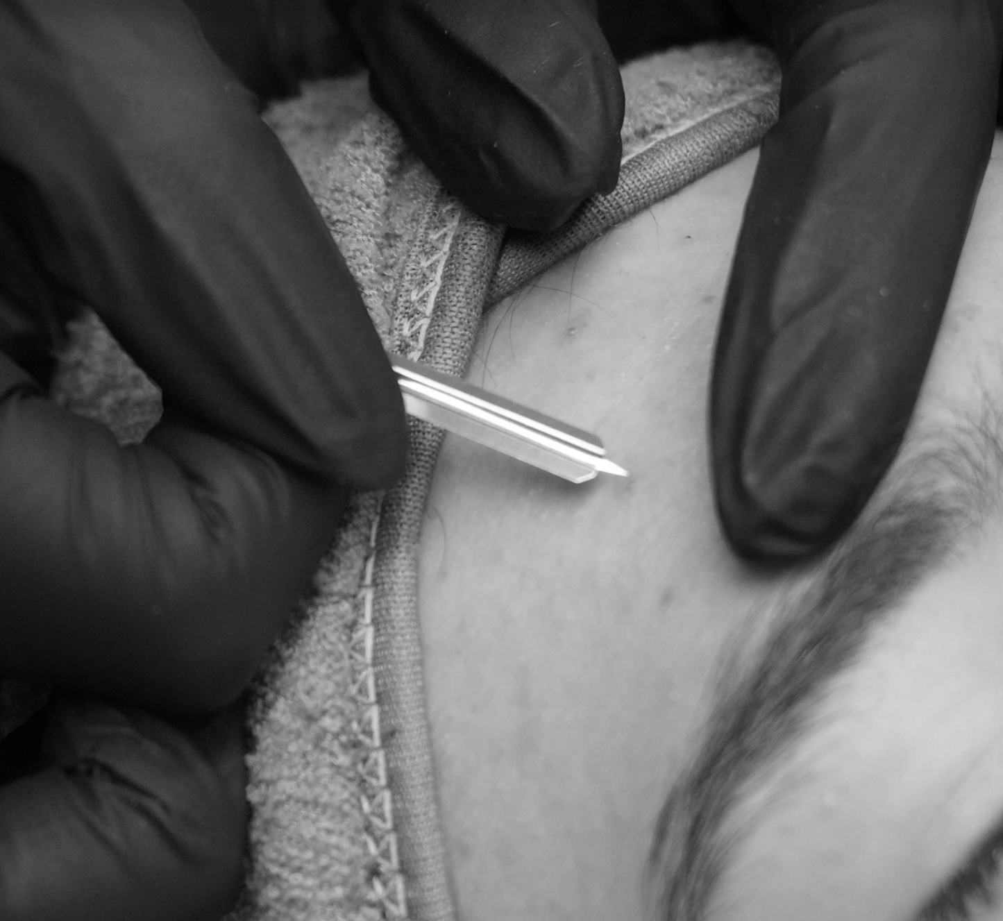A medical professional wearing black gloves administers an injection into a person's arm.