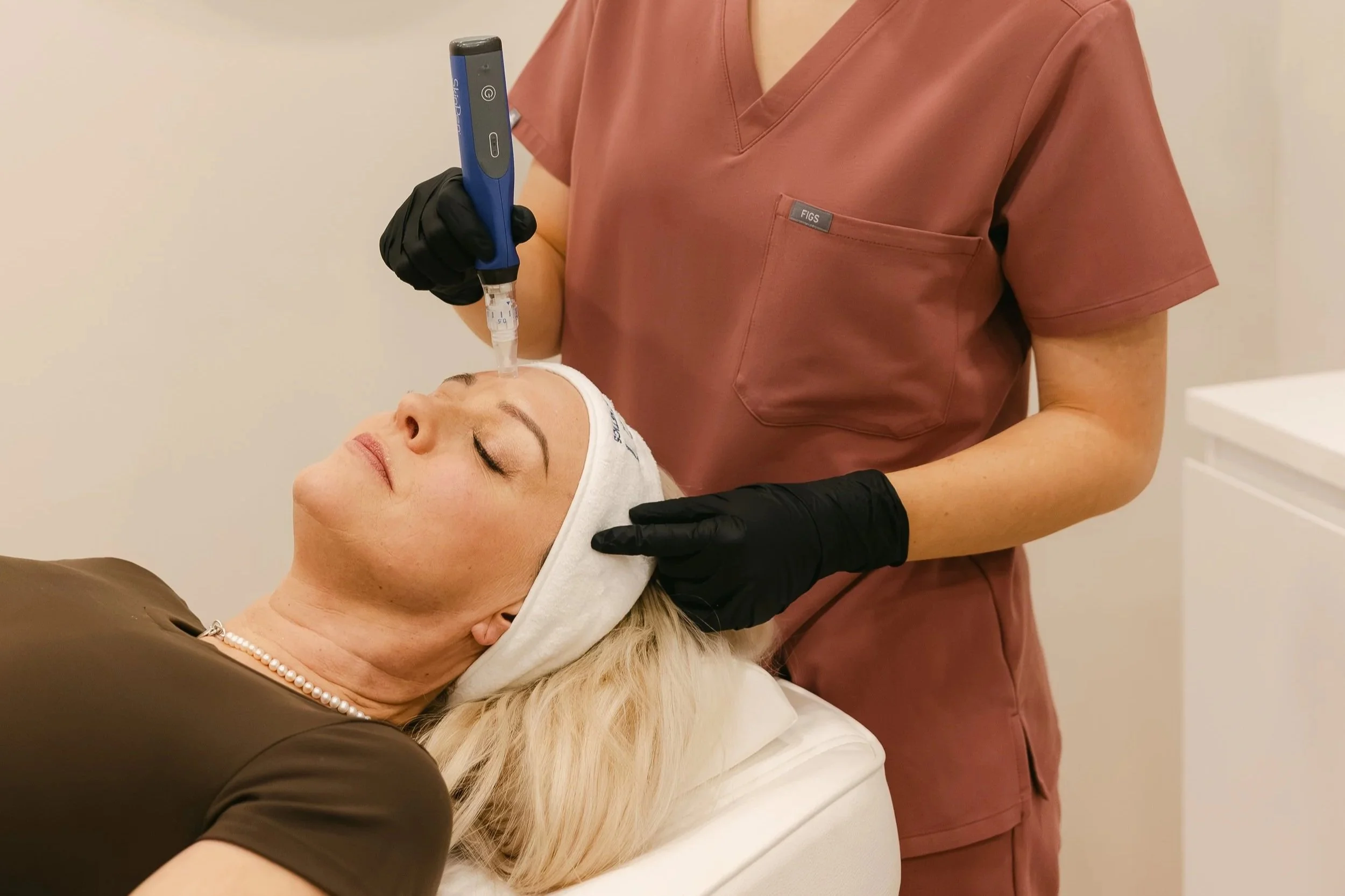 Microneedling Mapperley