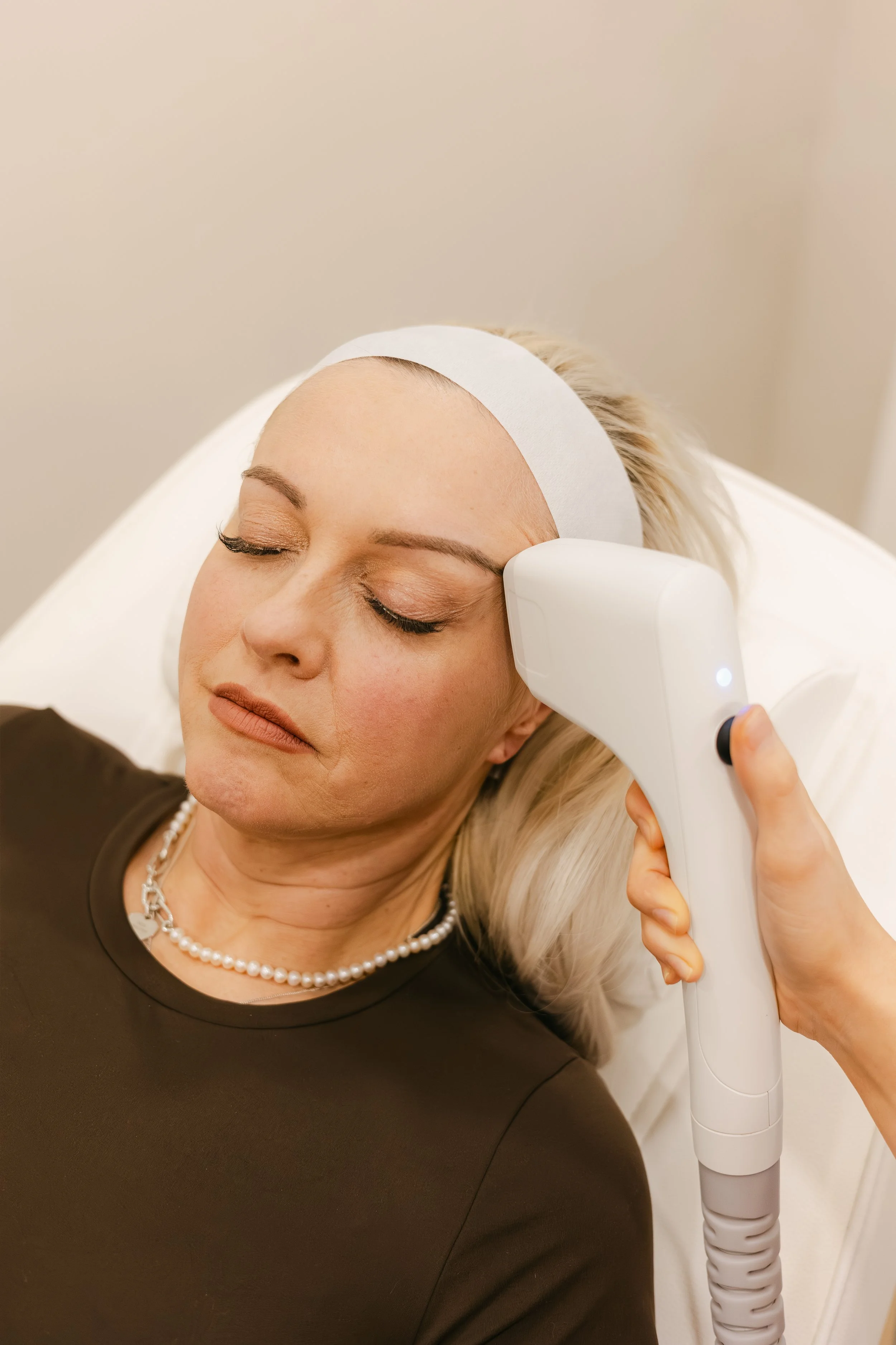sofwave non surgical face lift