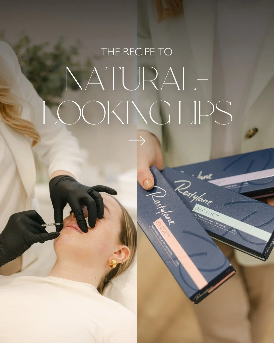 There is an art to natural lip enhancement, and it has very little to do with the amount of filler used.

Most of the patients coming to us for lip filler say the same thing. They want a subtle improvement in shape, volume and hydration- not a totall