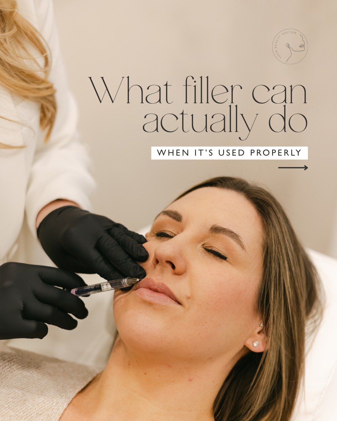 Filler gets a bad reputation, and we completely get why.

Most people&rsquo;s reference point is overfilled lips or faces that just don&rsquo;t look right anymore. So it&rsquo;s no surprise that when you start noticing changes in your own face, there