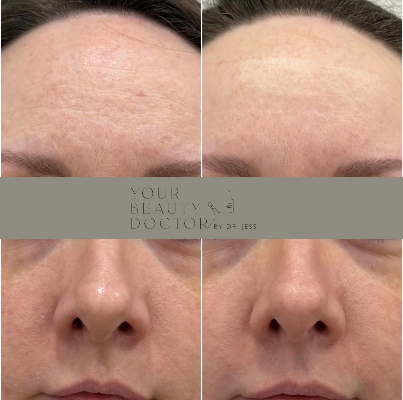 laser skin treatment nottingham