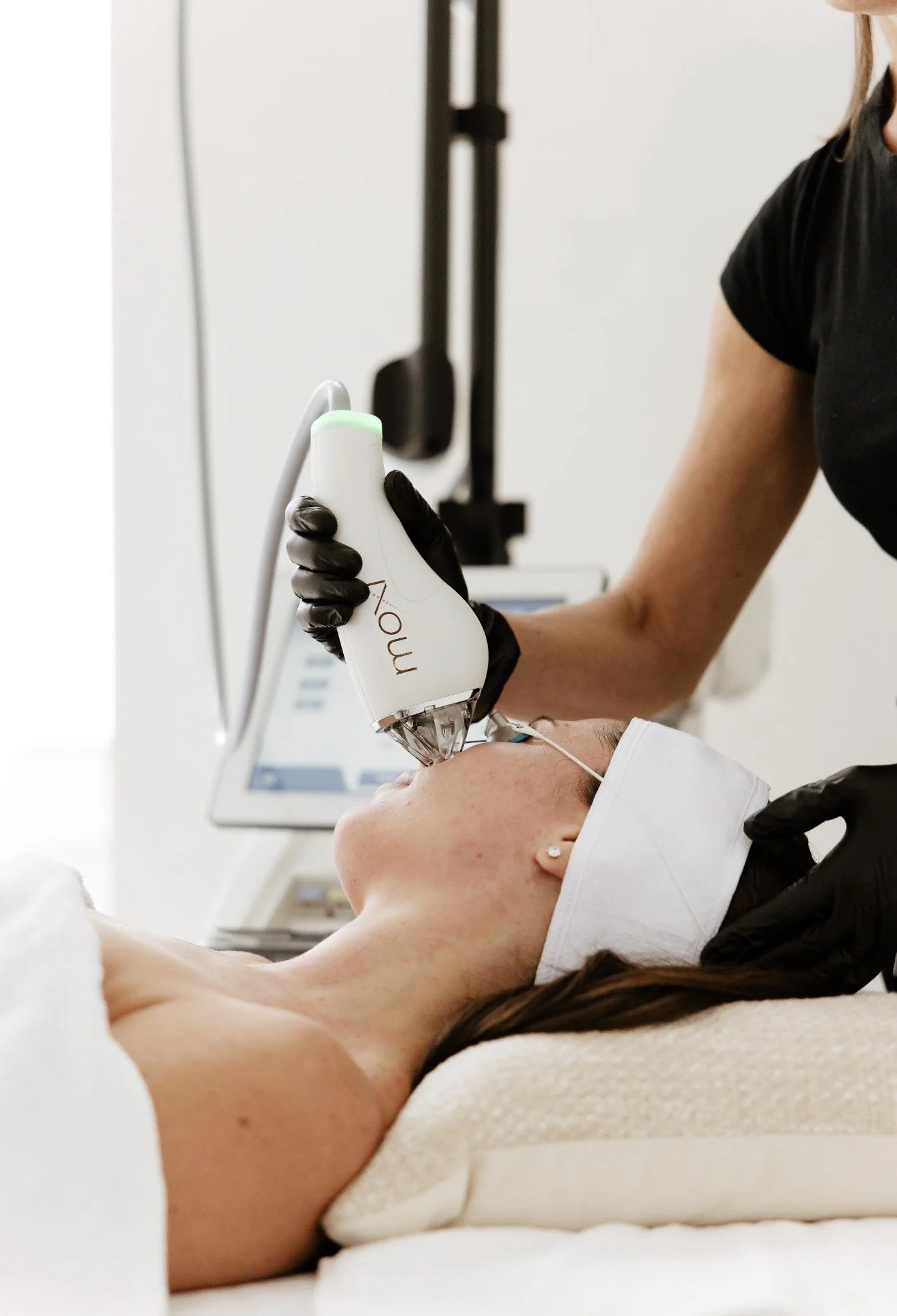 moxi laser Nottingham